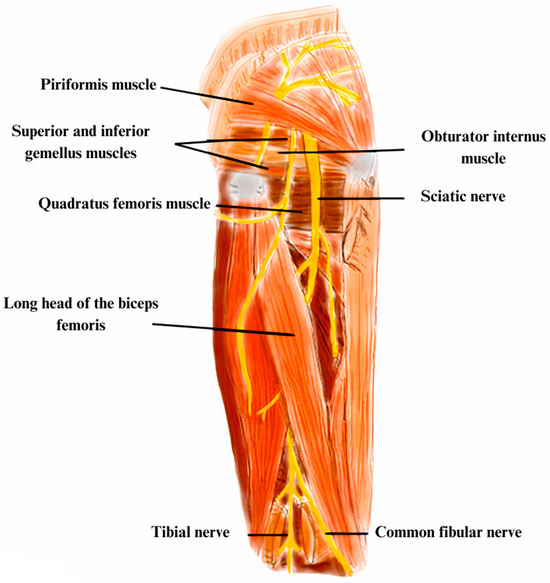 Diagnostic Approach to Lower Limb Entrapment Neuropathies: A