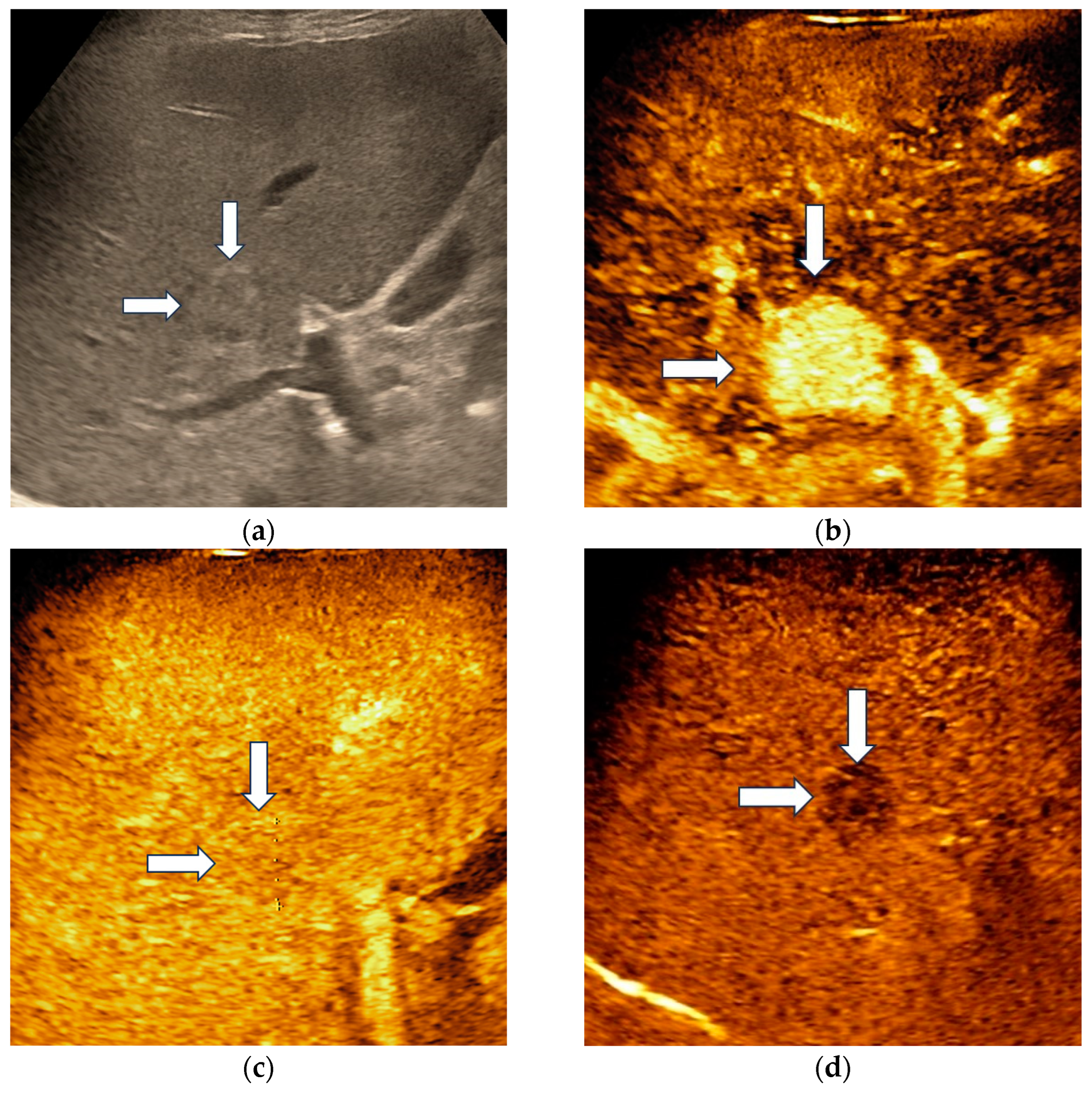Diagnostics 13 03387 g002 Diagnostics 13 03387 g002