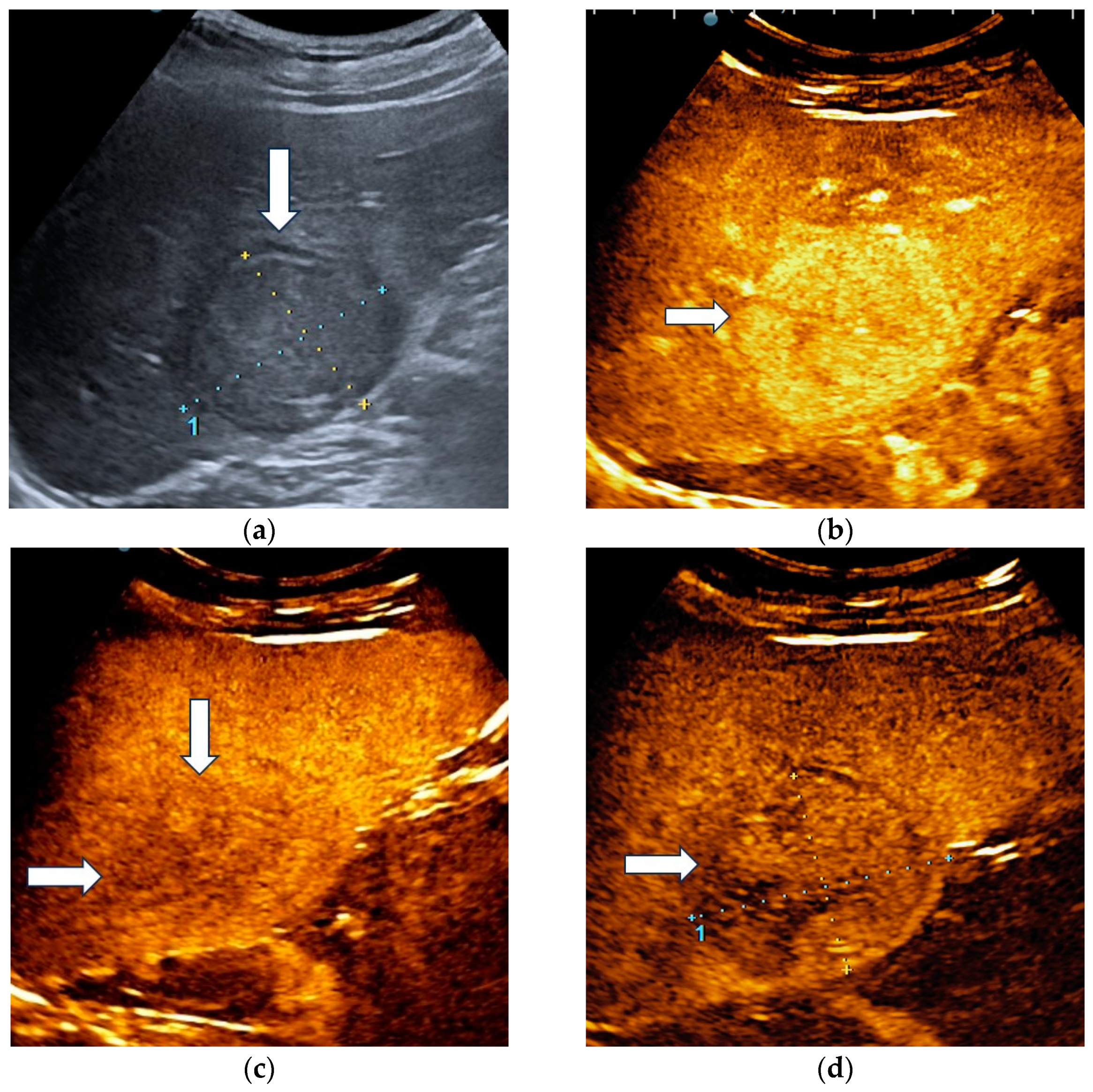 Diagnostics 13 03387 g004 Diagnostics 13 03387 g004