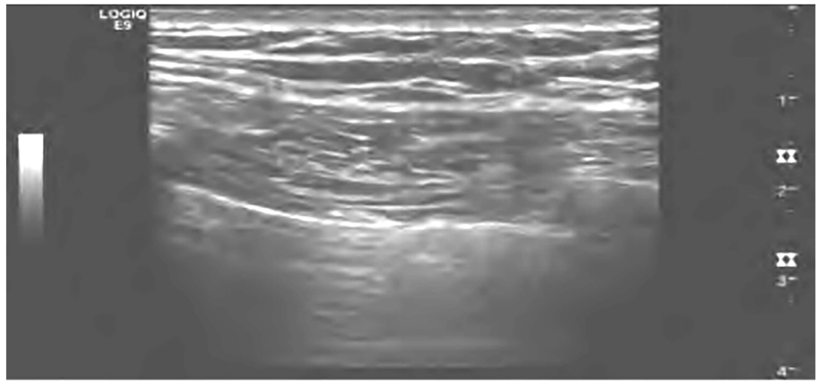 Diagnostics 13 03388 g005 Diagnostics 13 03388 g005