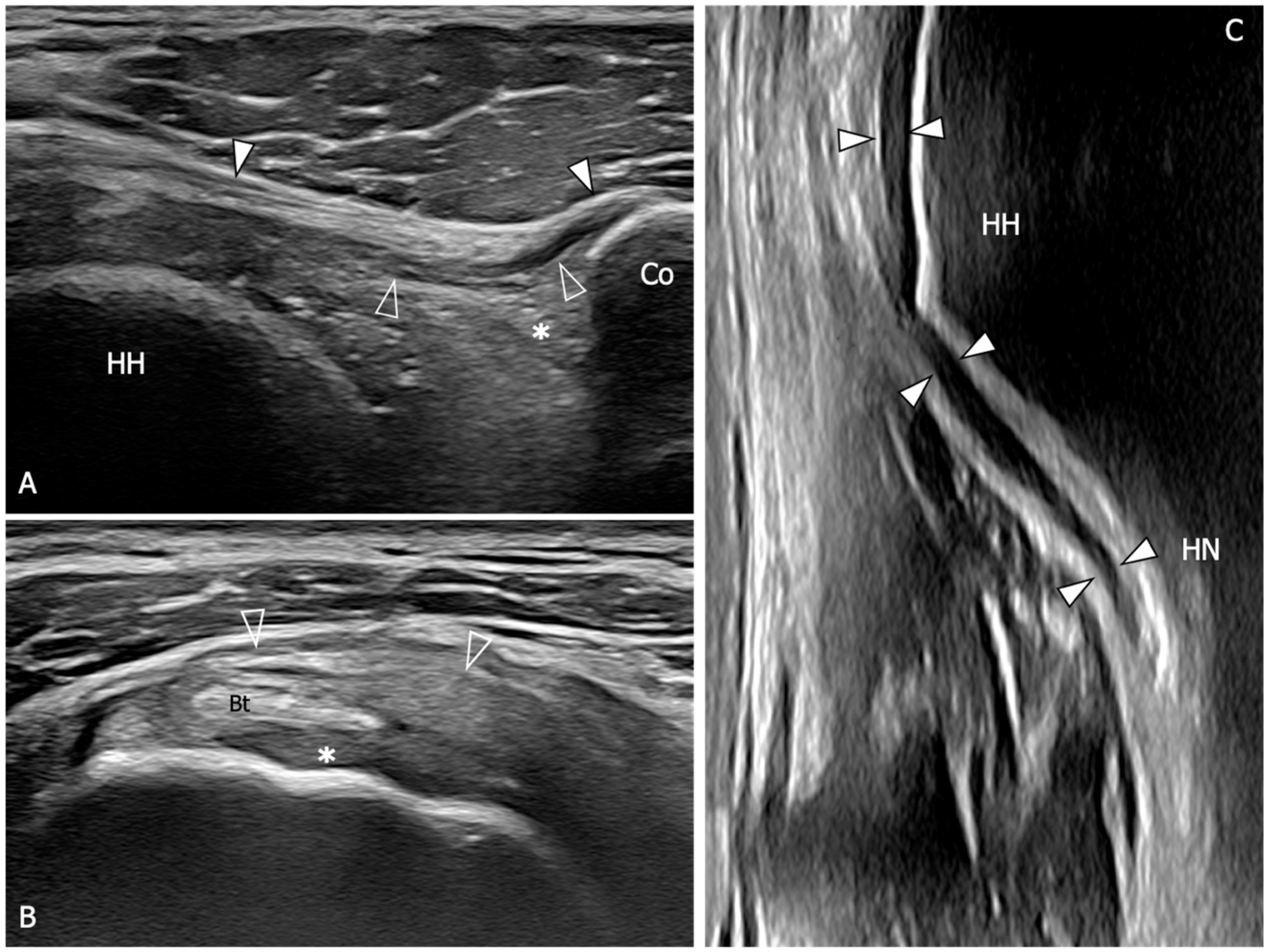 Diagnostics 13 03410 g005 Diagnostics 13 03410 g005