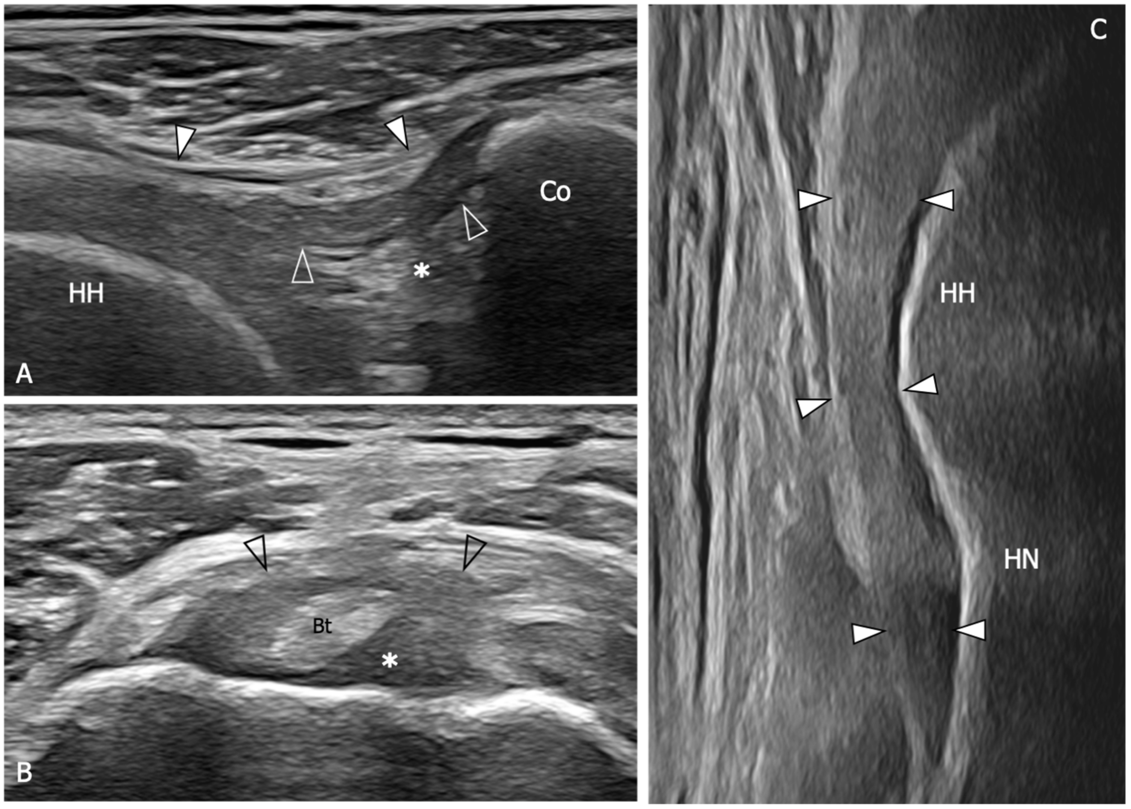 Diagnostics 13 03410 g006 Diagnostics 13 03410 g006