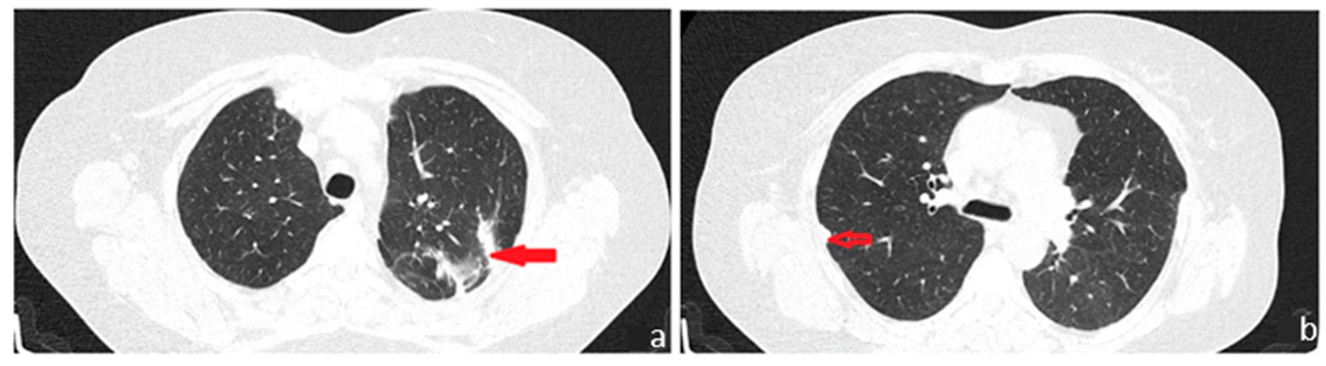 Diagnostics 13 03411 g004