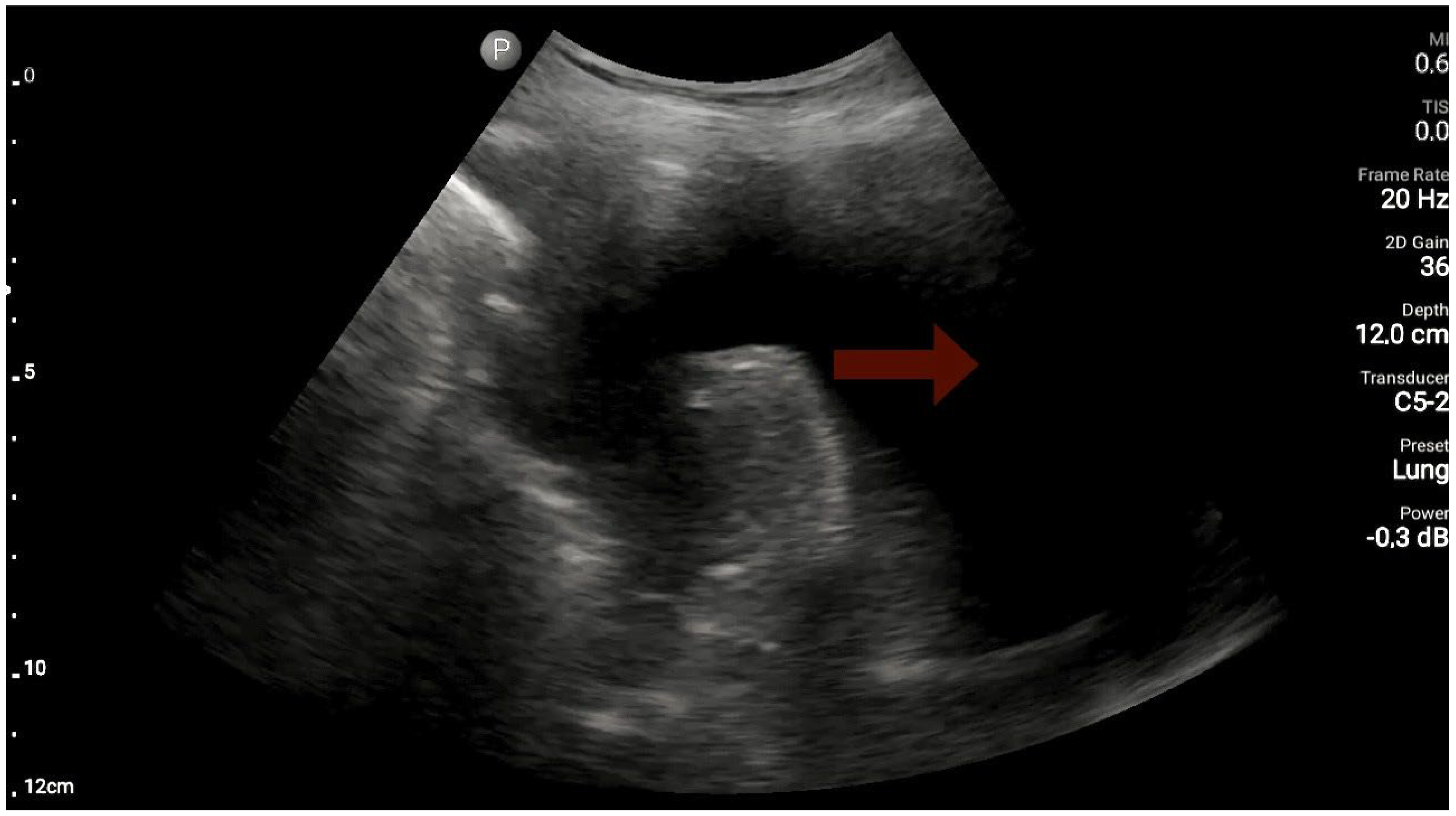 Diagnostics 13 03412 g006