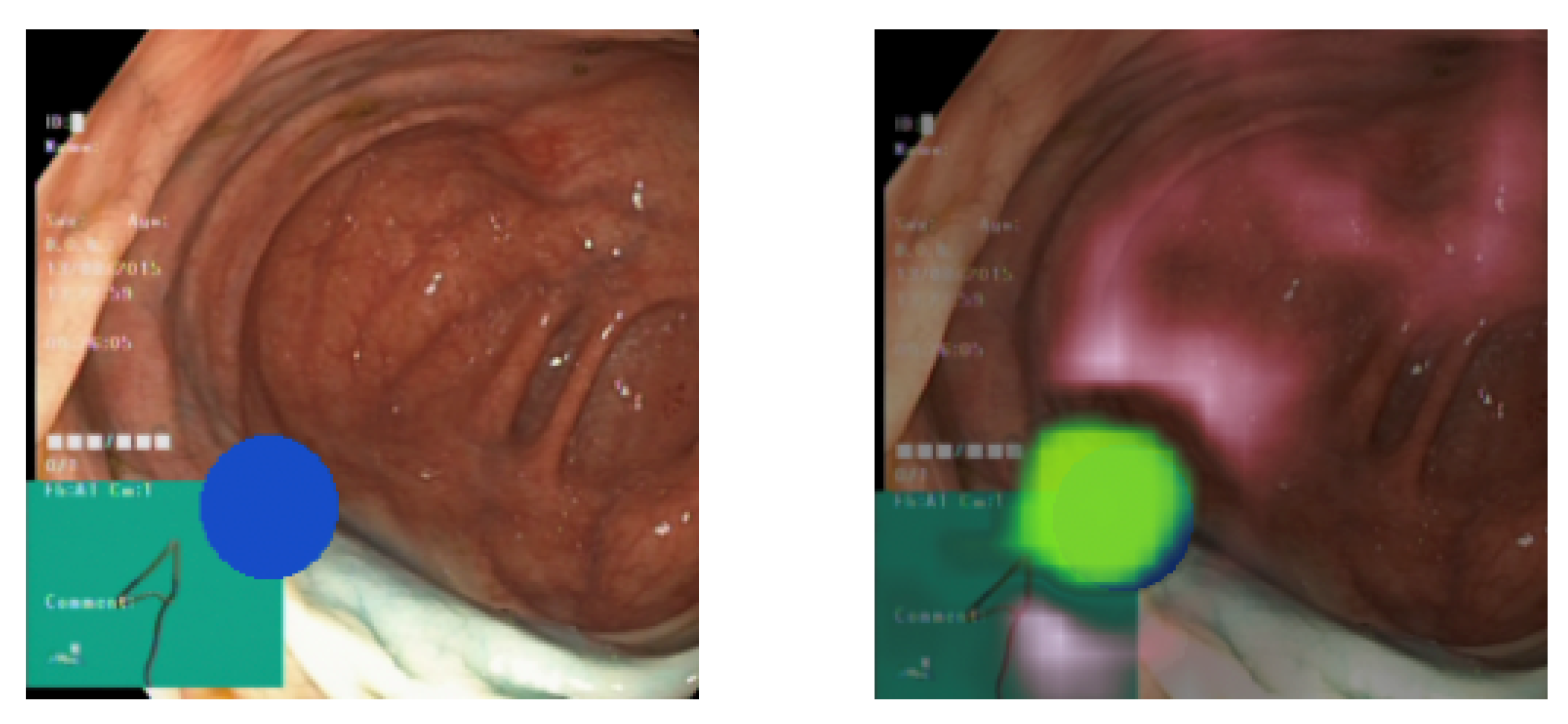 Diagnostics 13 03413 g006