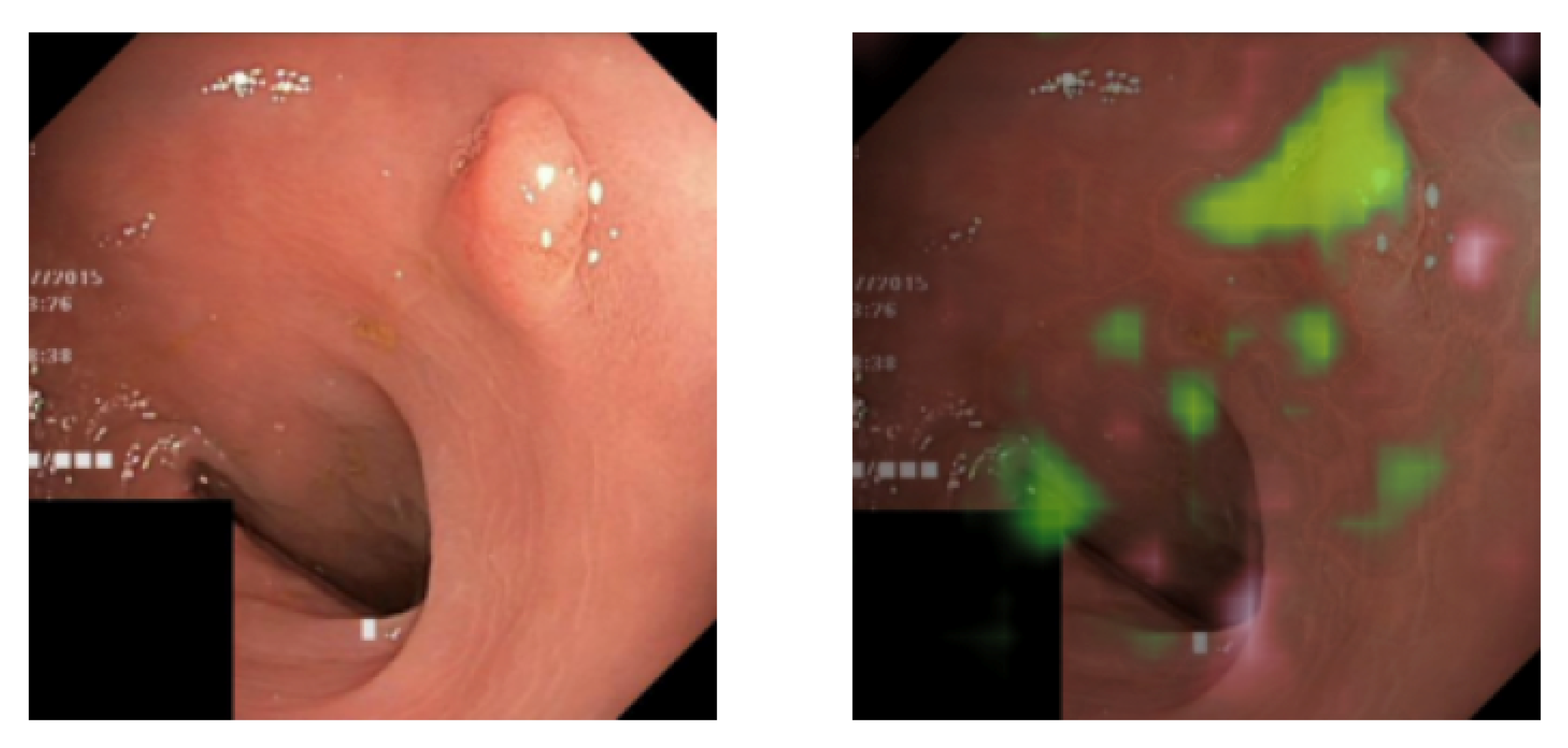 Diagnostics 13 03413 g007