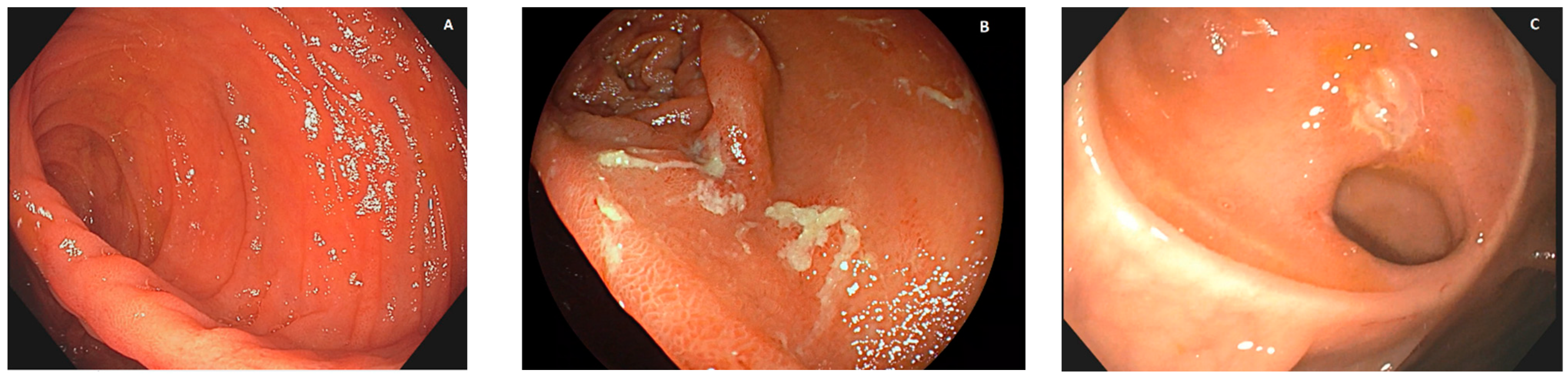 Diagnostics 13 03423 g001