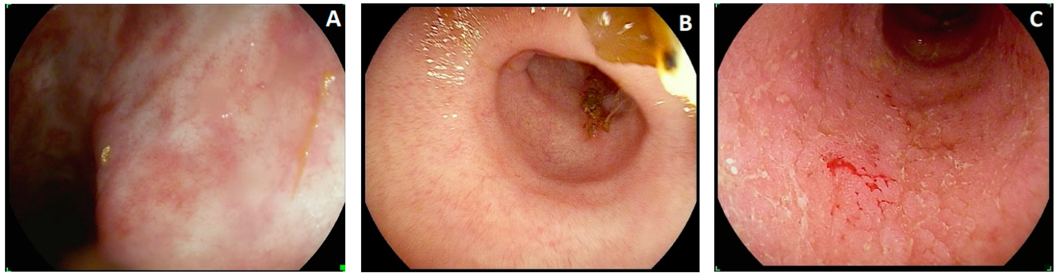 Diagnostics 13 03423 g003