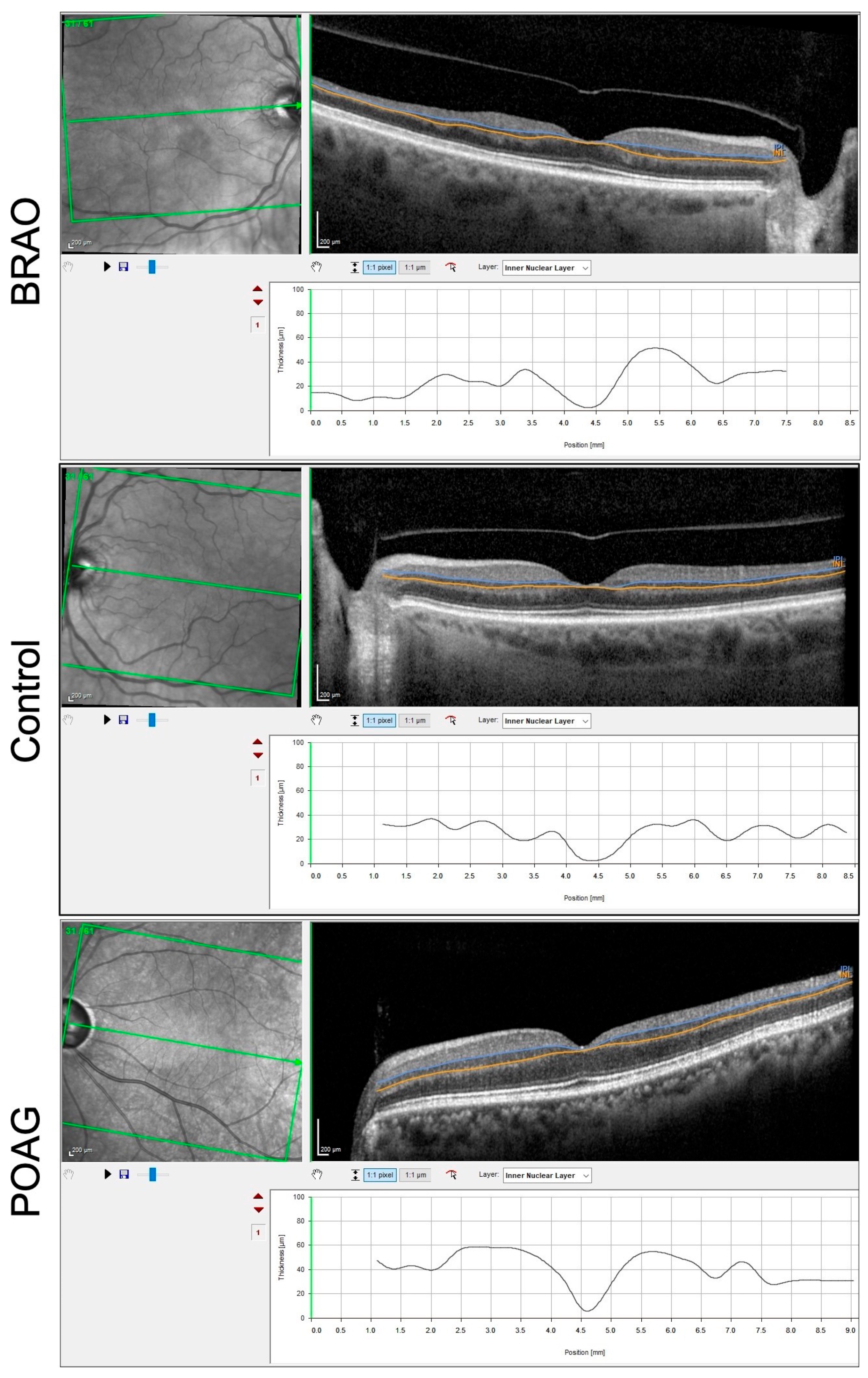 Diagnostics 13 03428 g003