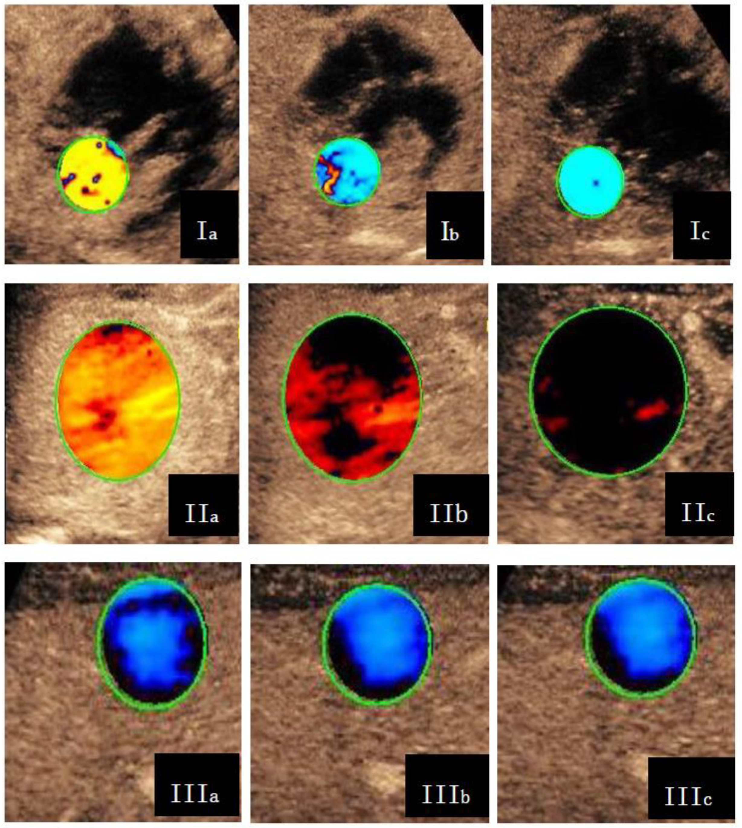 Diagnostics 13 03443 g002