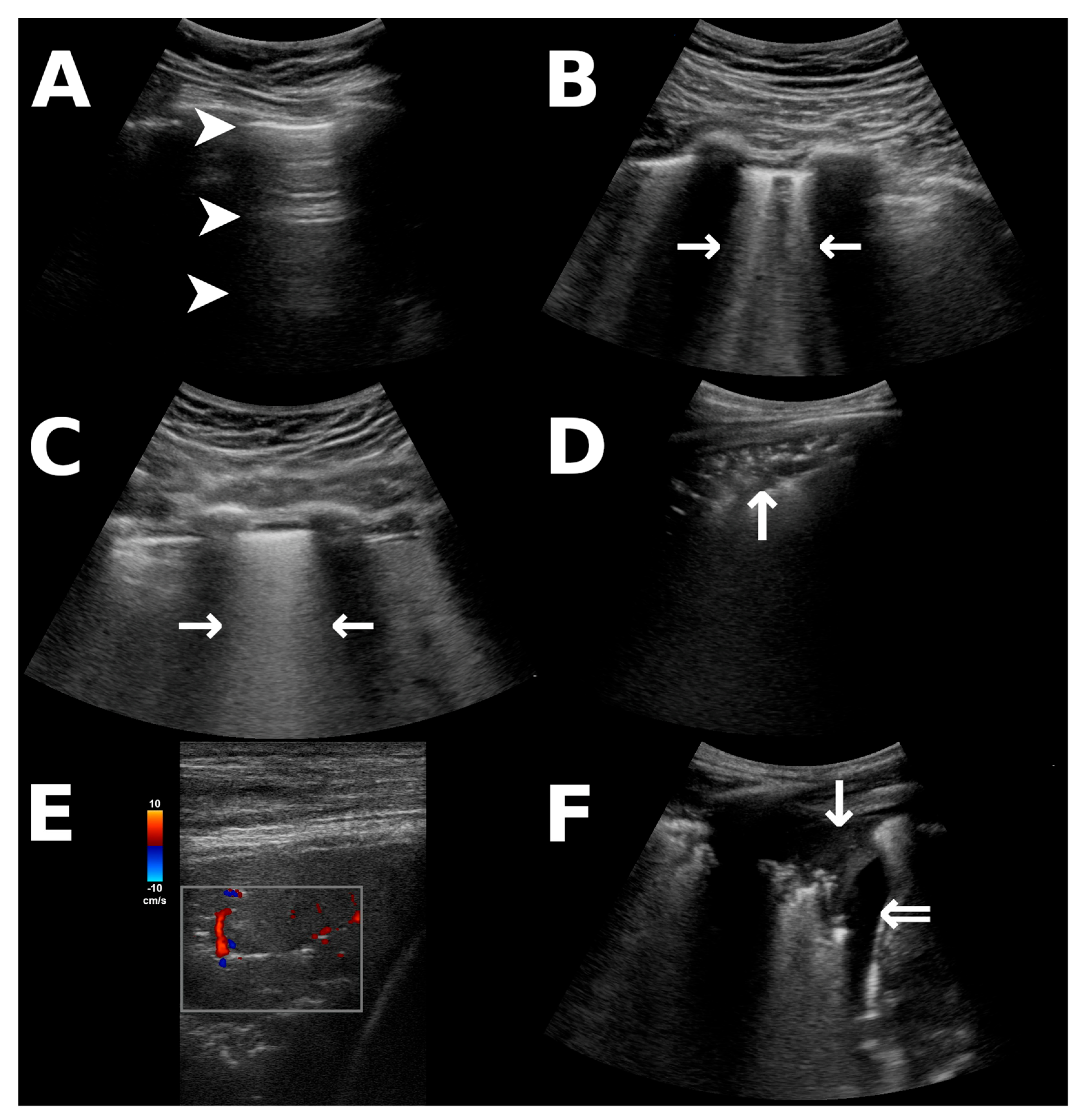 Diagnostics 13 03446 g001