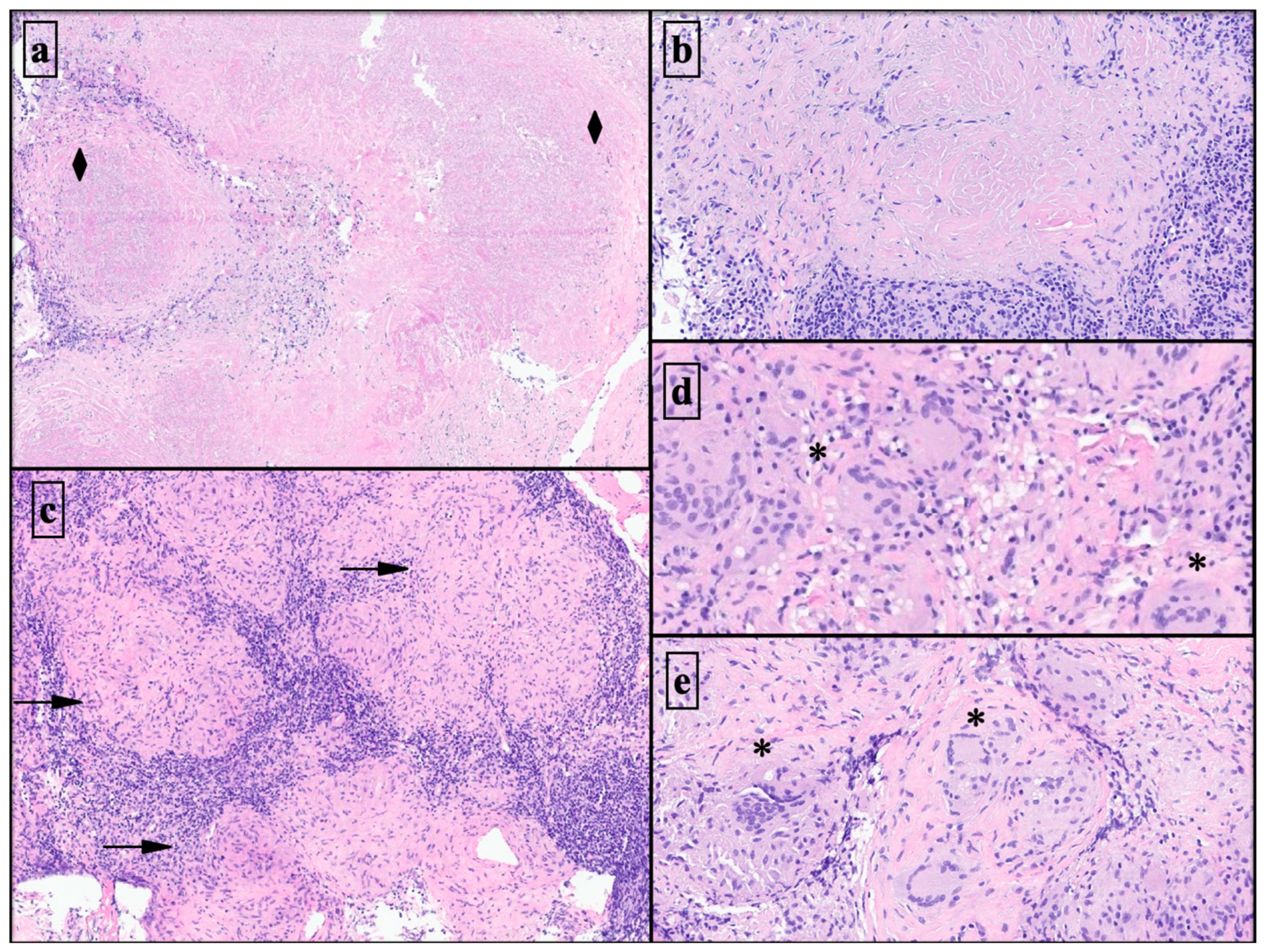 Diagnostics 13 03476 g005