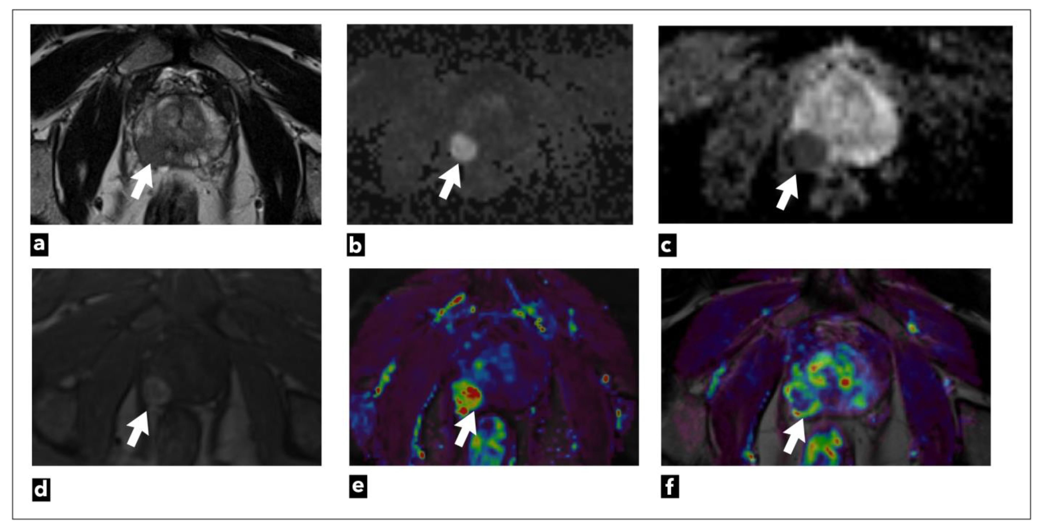 Diagnostics 13 03488 g002 Diagnostics 13 03488 g002