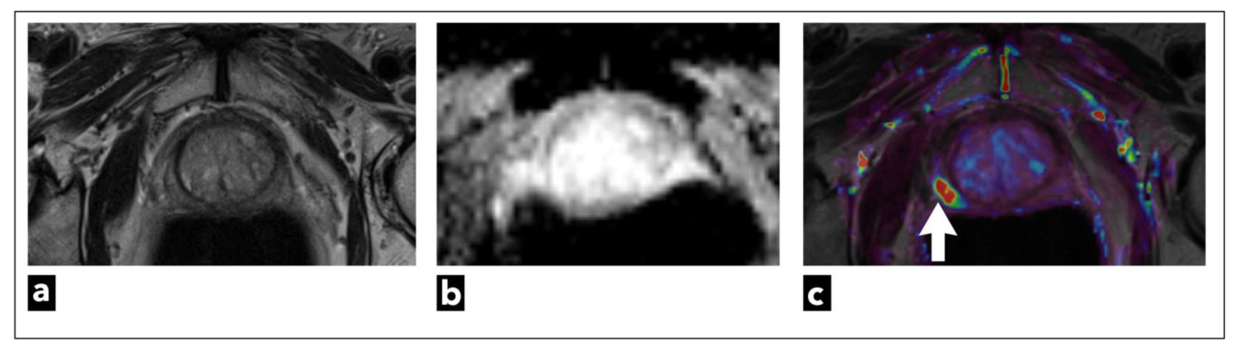 Diagnostics 13 03488 g008 Diagnostics 13 03488 g008