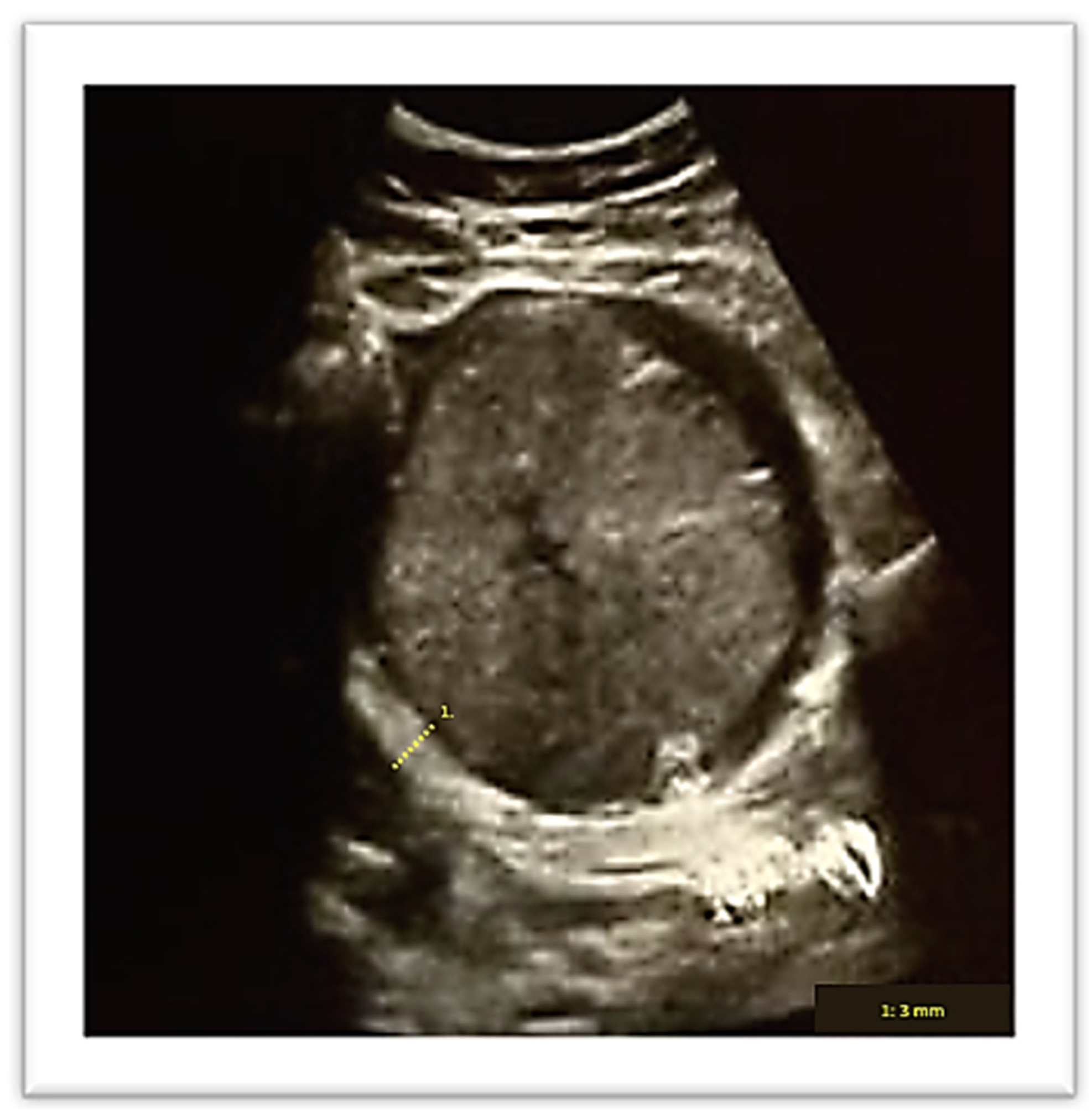 Diagnostics 13 03492 g002 Diagnostics 13 03492 g002