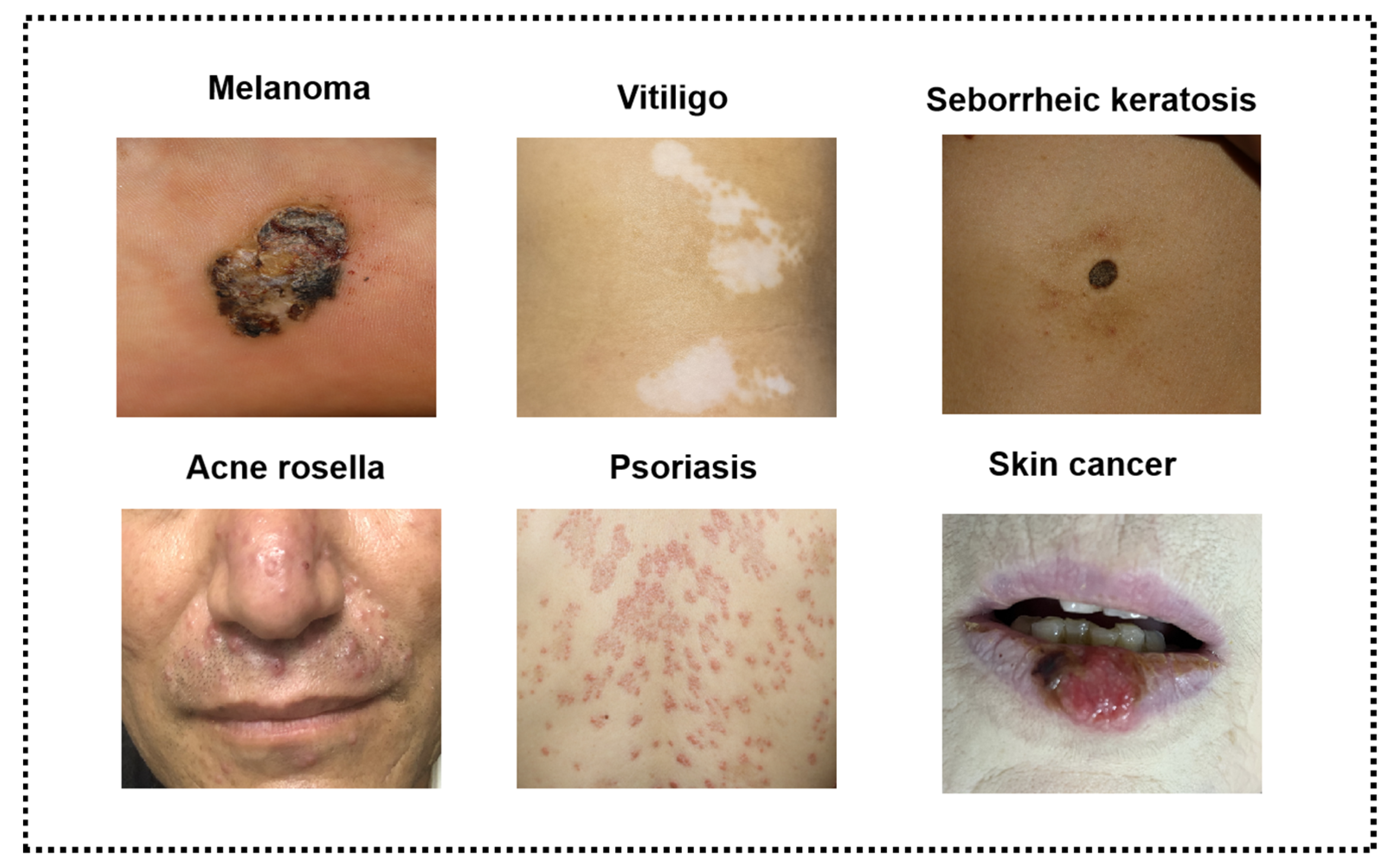 Skin disorders discount