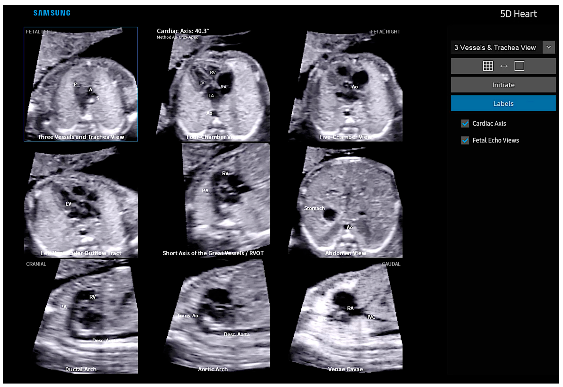 Diagnostics 13 03509 g003