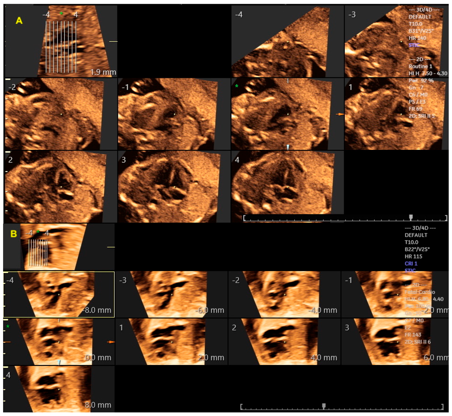 Diagnostics 13 03509 g004