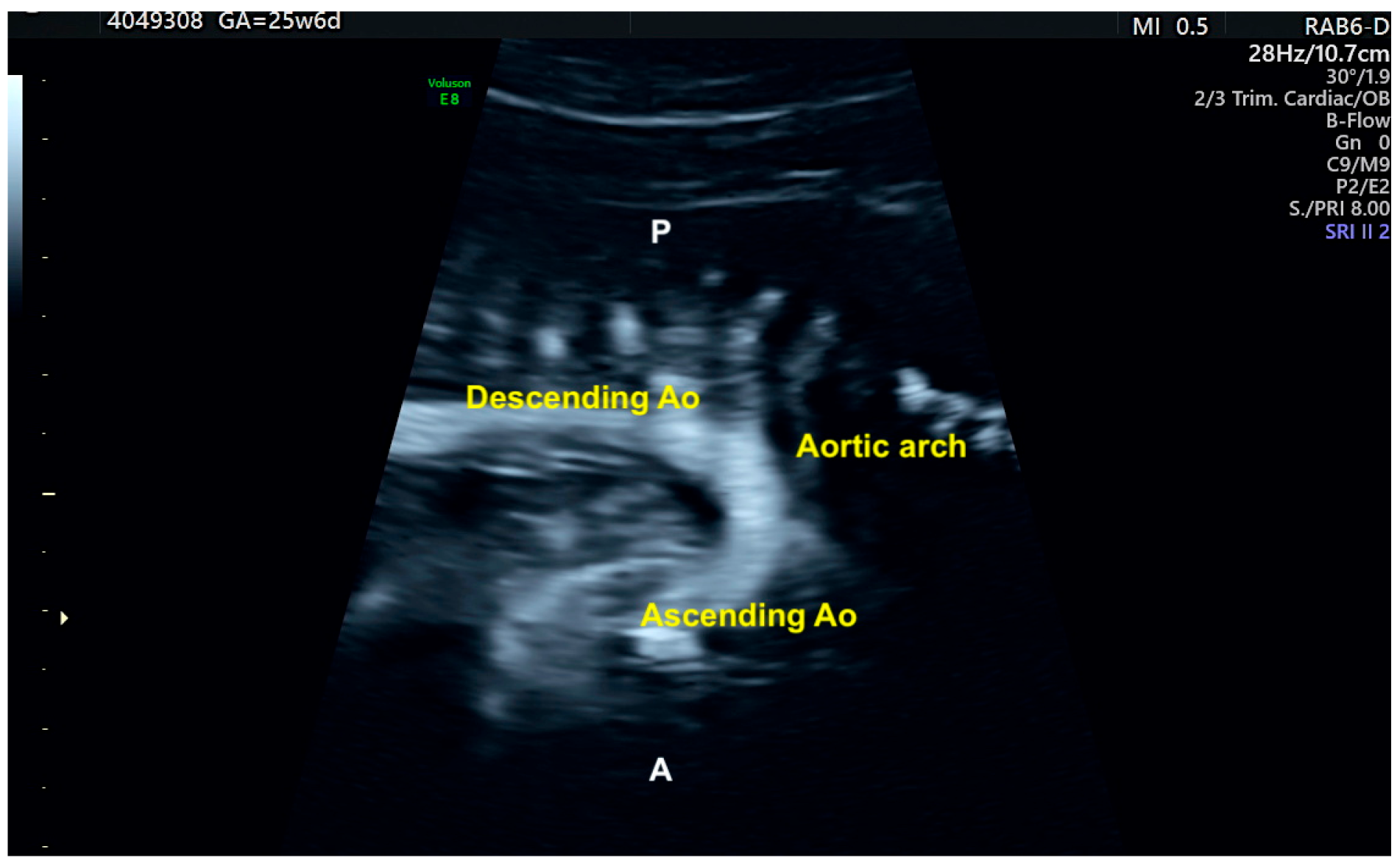 Diagnostics 13 03509 g005