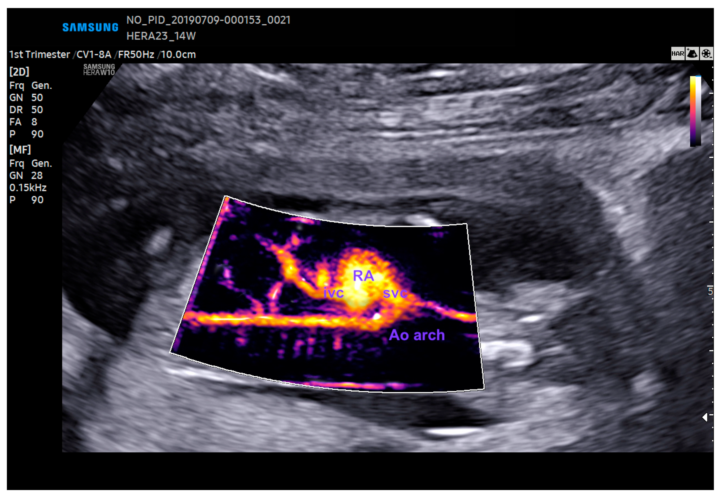 Diagnostics 13 03509 g011