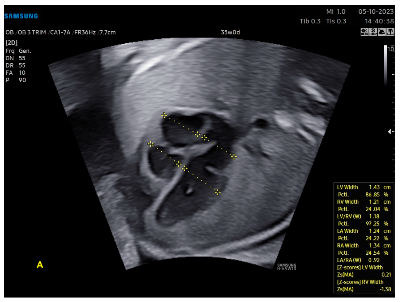 Diagnostics 13 03509 g012a
