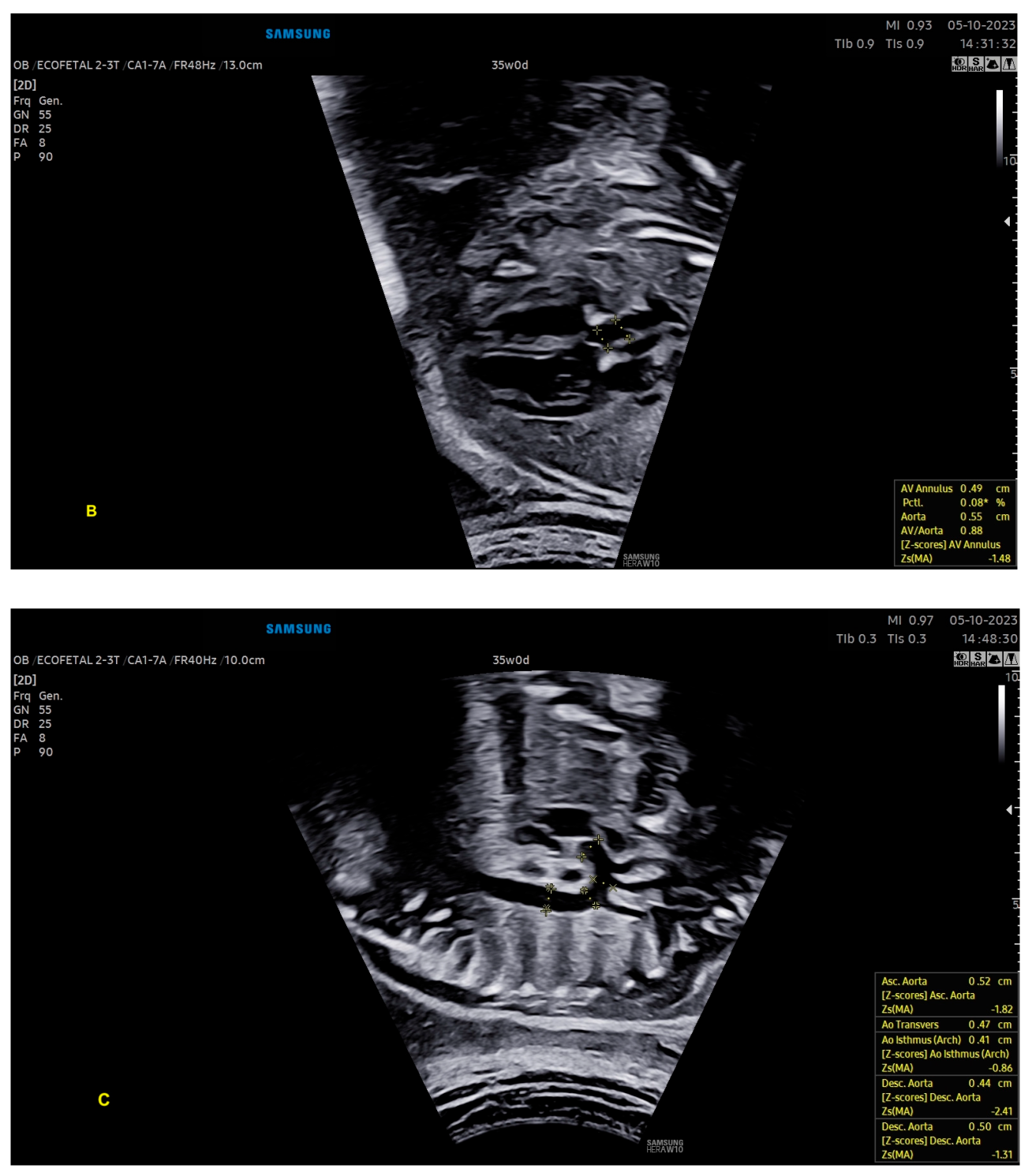 Diagnostics 13 03509 g012b