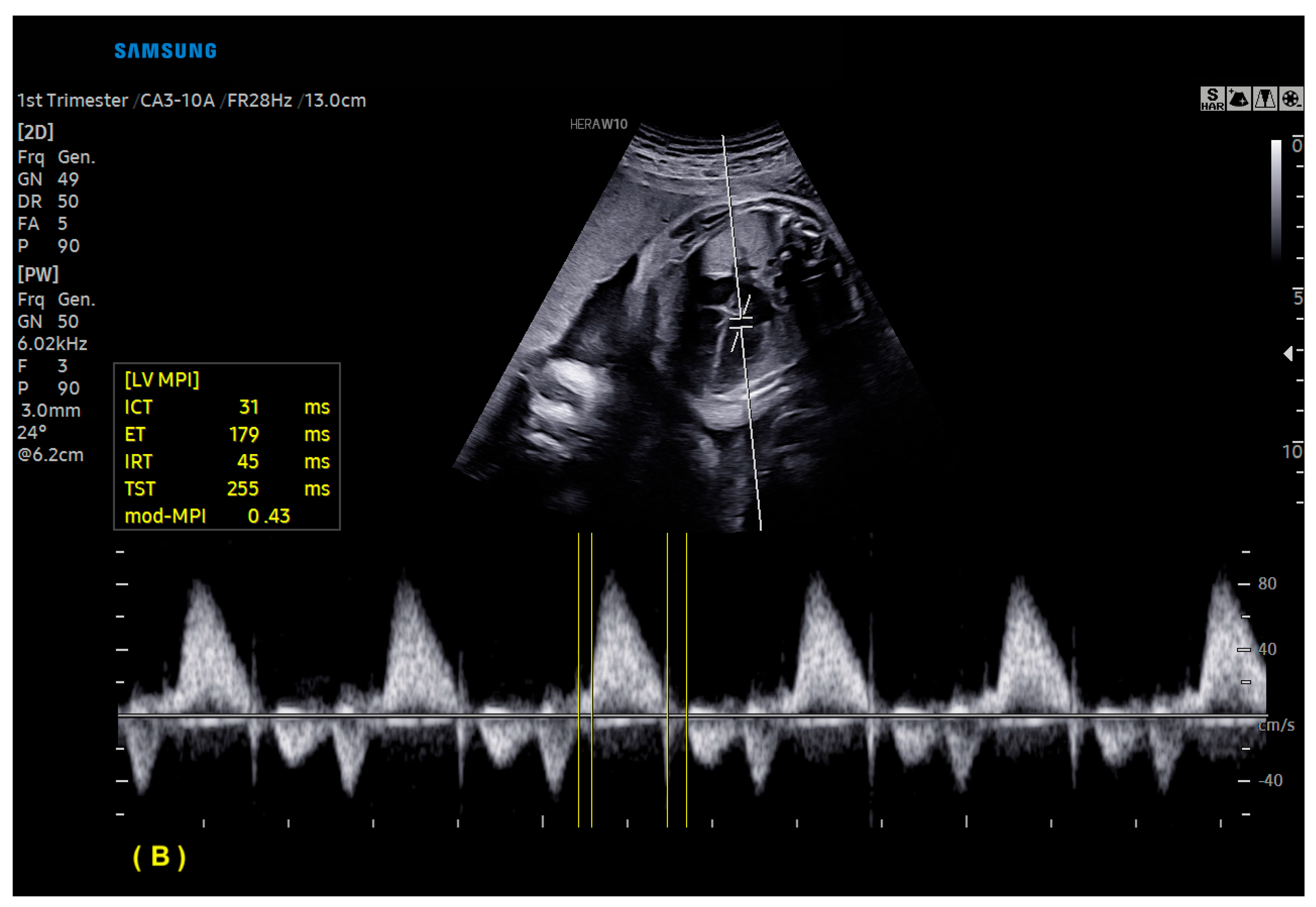 Diagnostics 13 03509 g013b