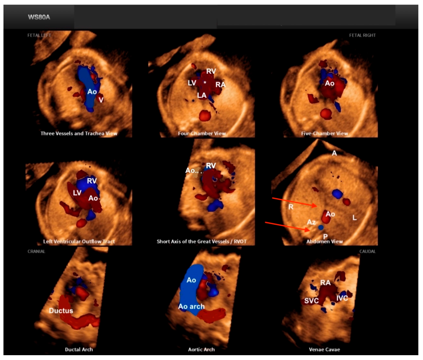 Diagnostics 13 03509 g014