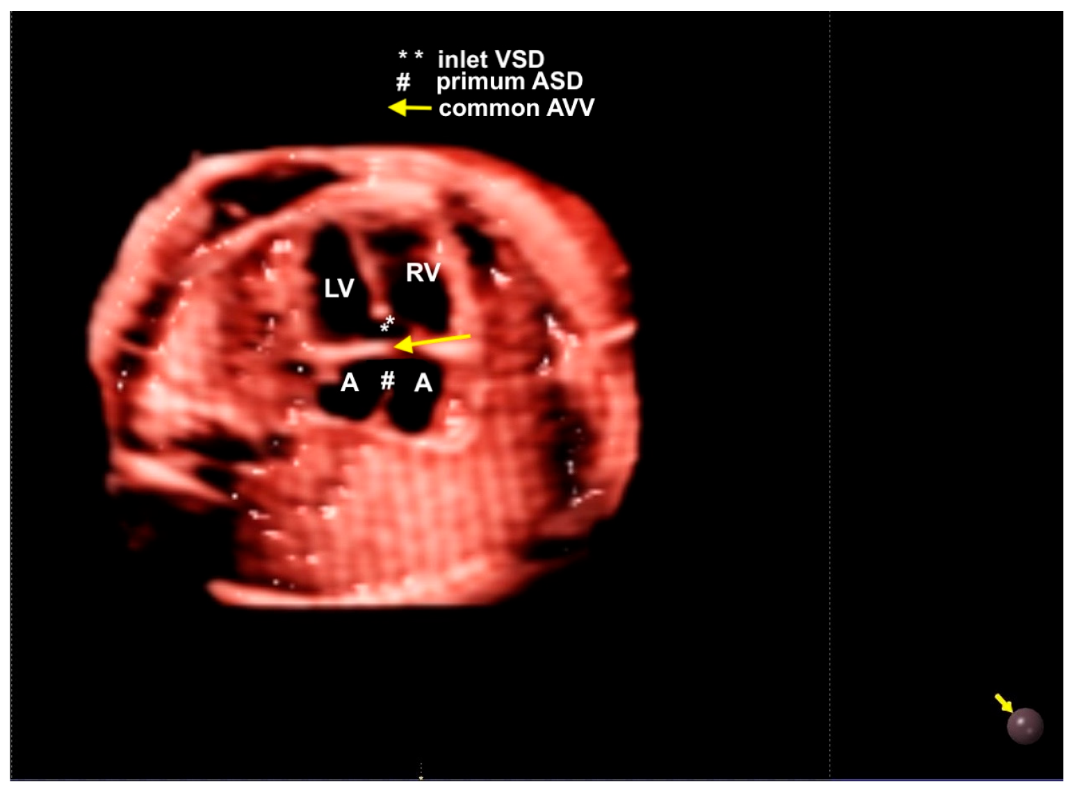 Diagnostics 13 03509 g017