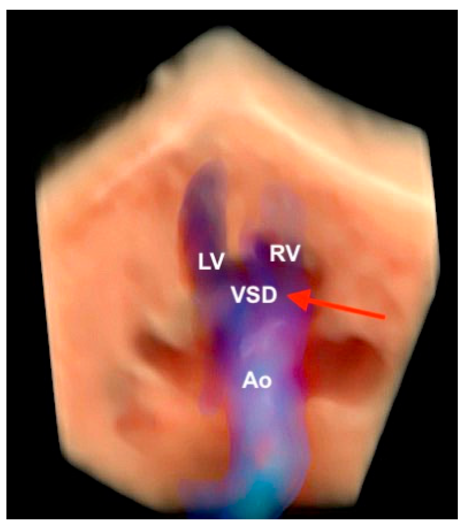 Diagnostics 13 03509 g021