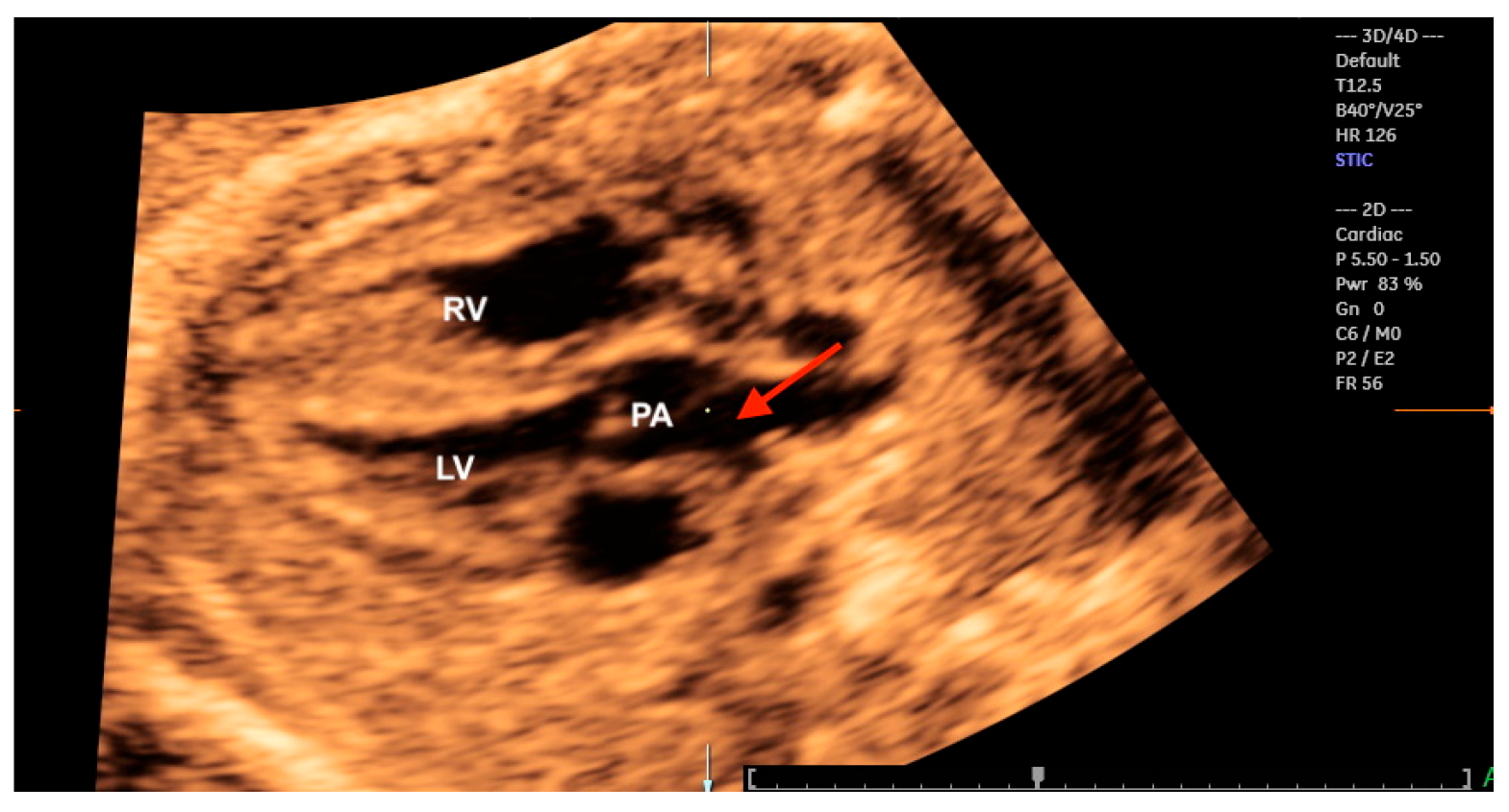 Diagnostics 13 03509 g022