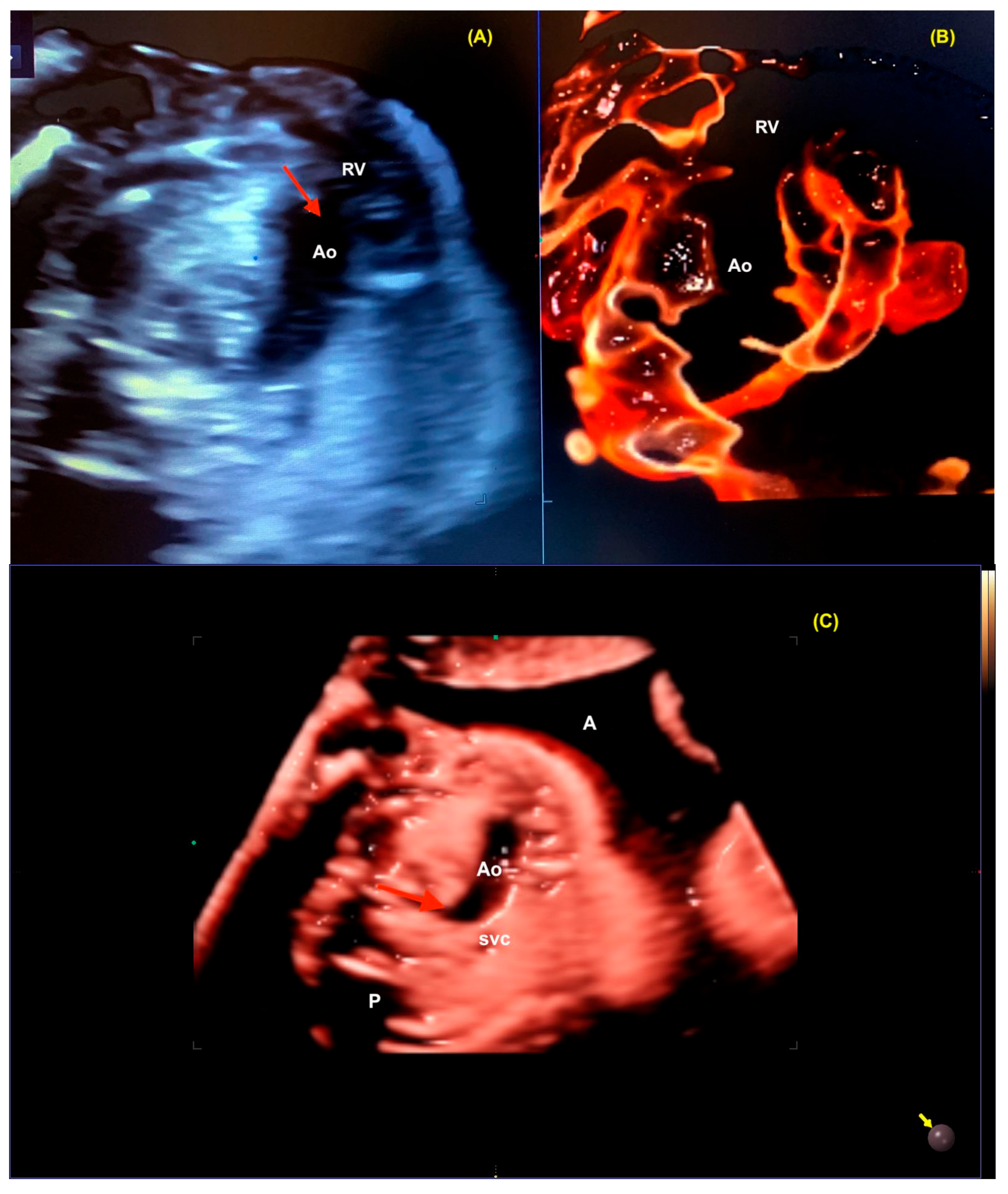 Diagnostics 13 03509 g023