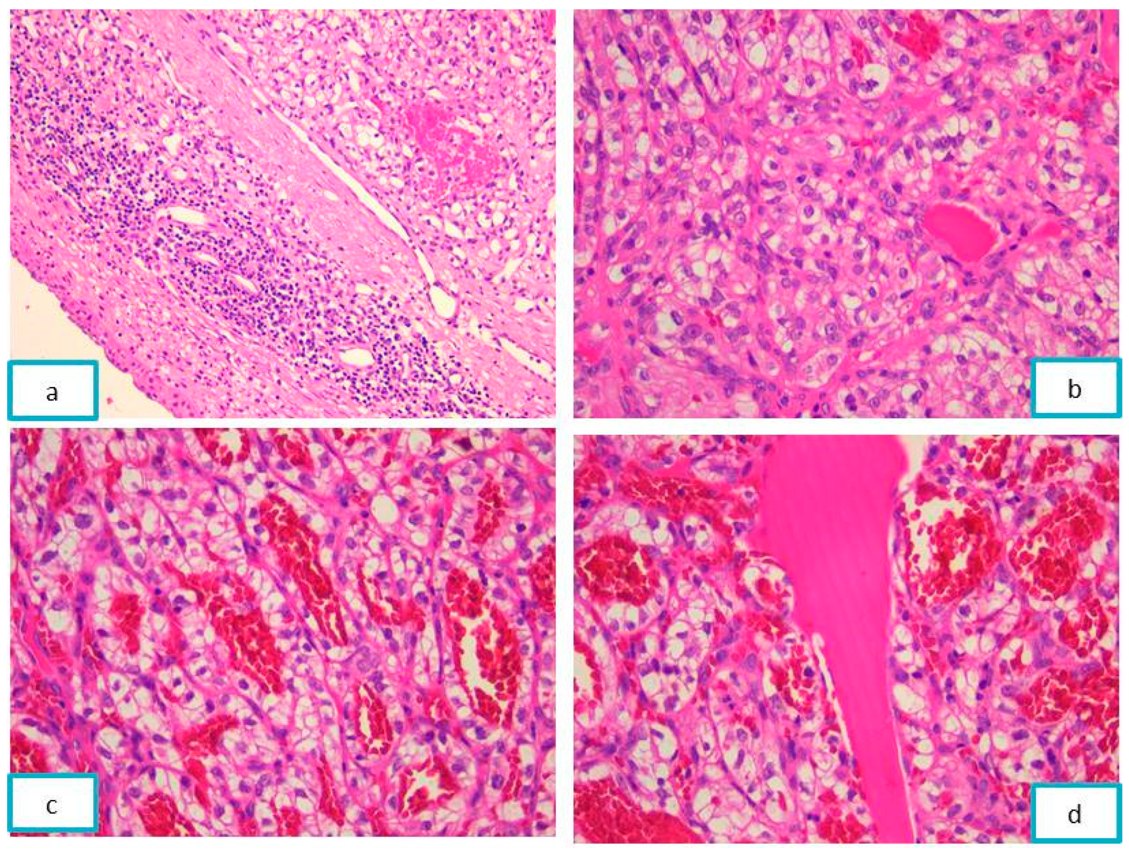 Diagnostics 13 03513 g004 Diagnostics 13 03513 g004