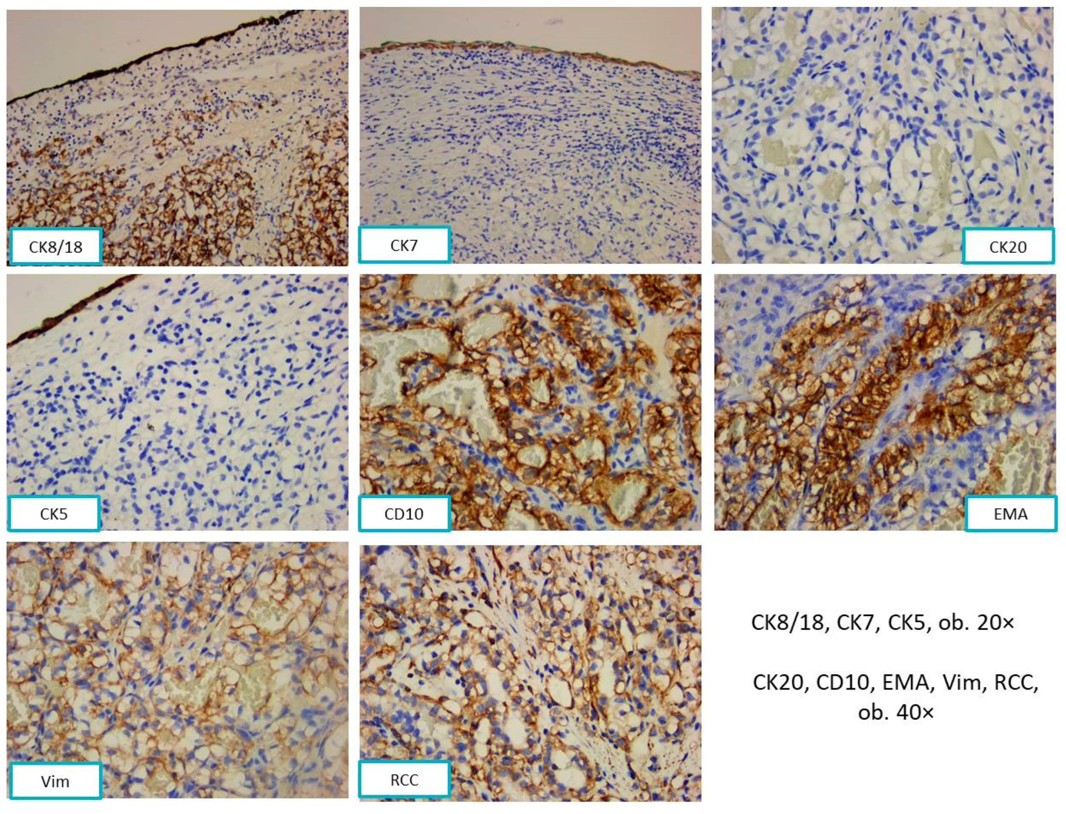 Diagnostics 13 03513 g005 Diagnostics 13 03513 g005