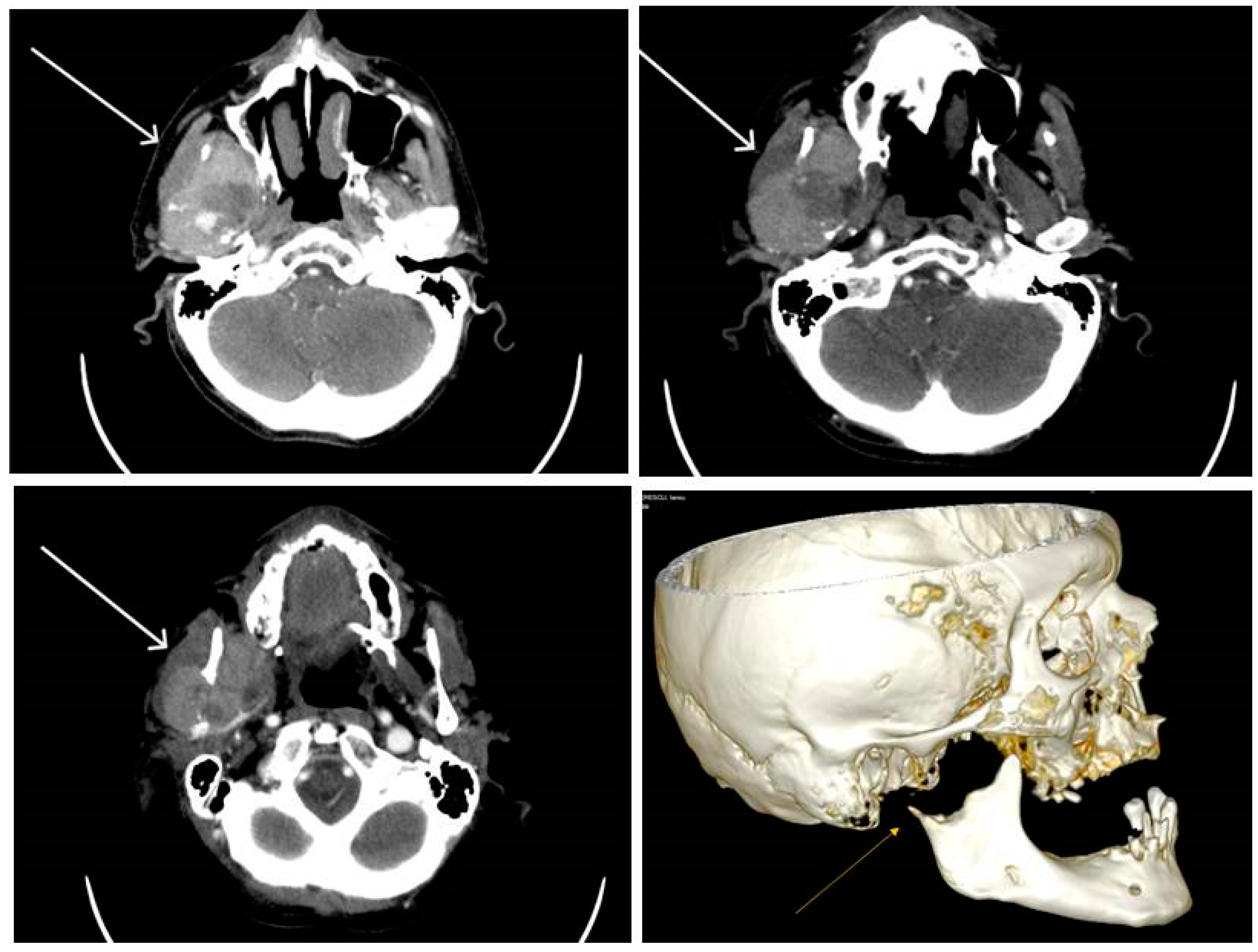 Diagnostics 13 03513 g007 Diagnostics 13 03513 g007