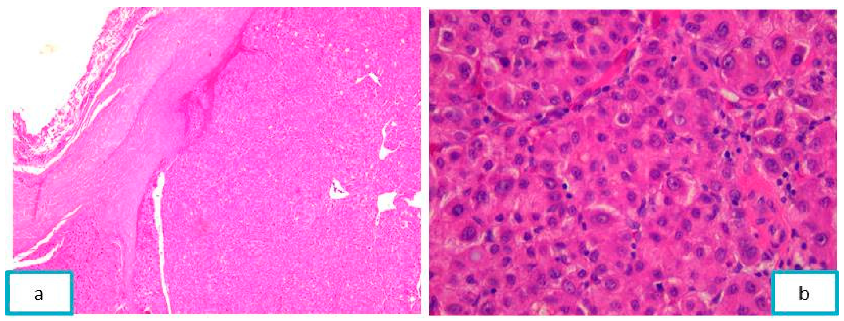 Diagnostics 13 03513 g008 Diagnostics 13 03513 g008