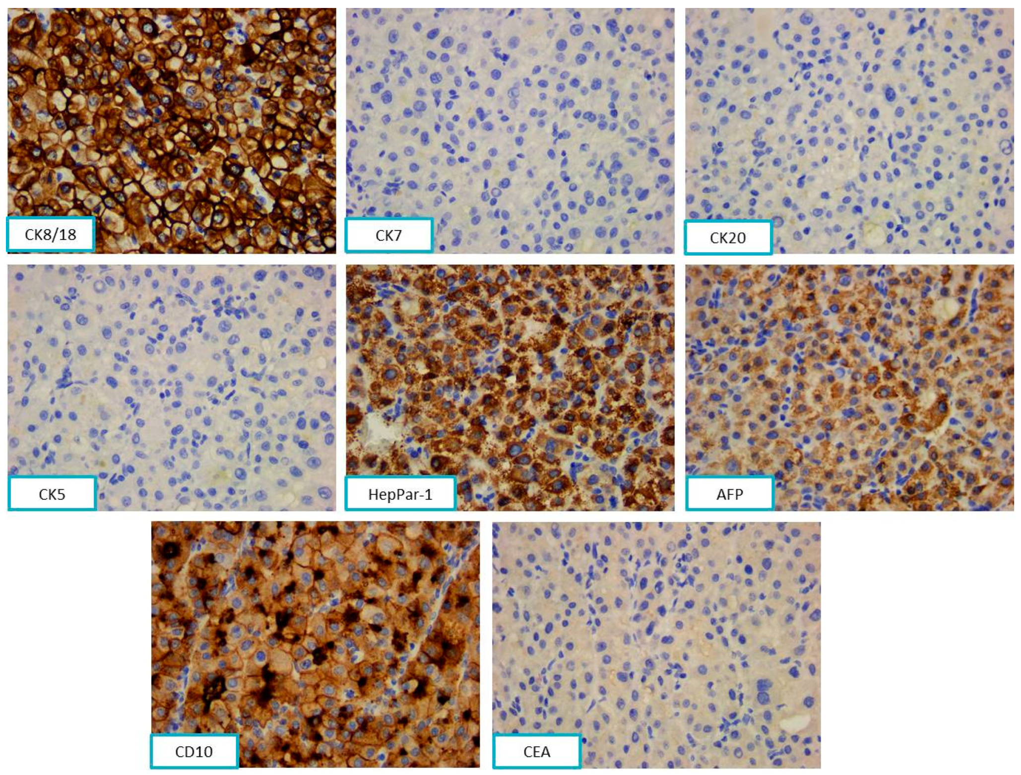 Diagnostics 13 03513 g009 Diagnostics 13 03513 g009