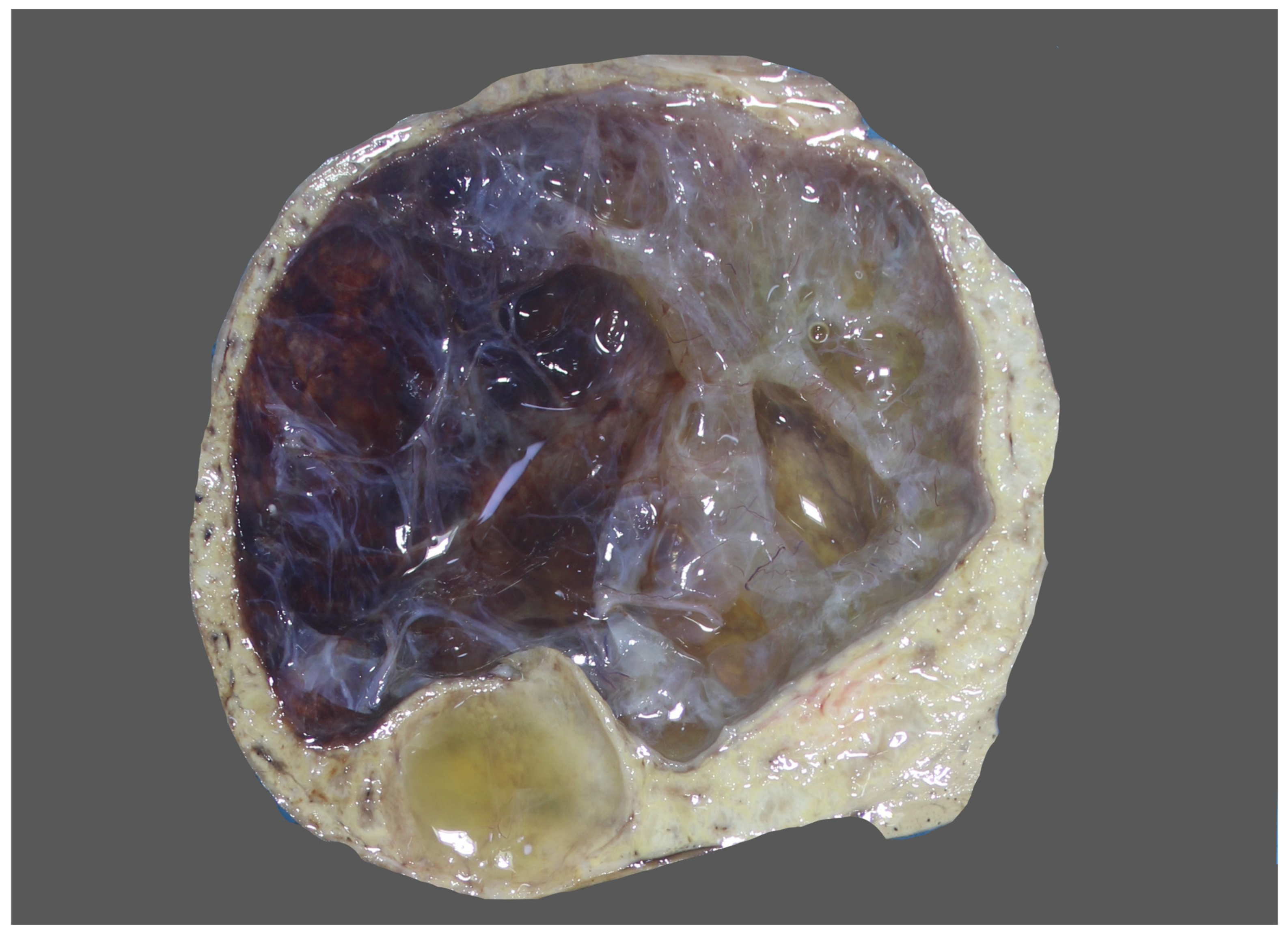 Diagnostics 13 03524 g007