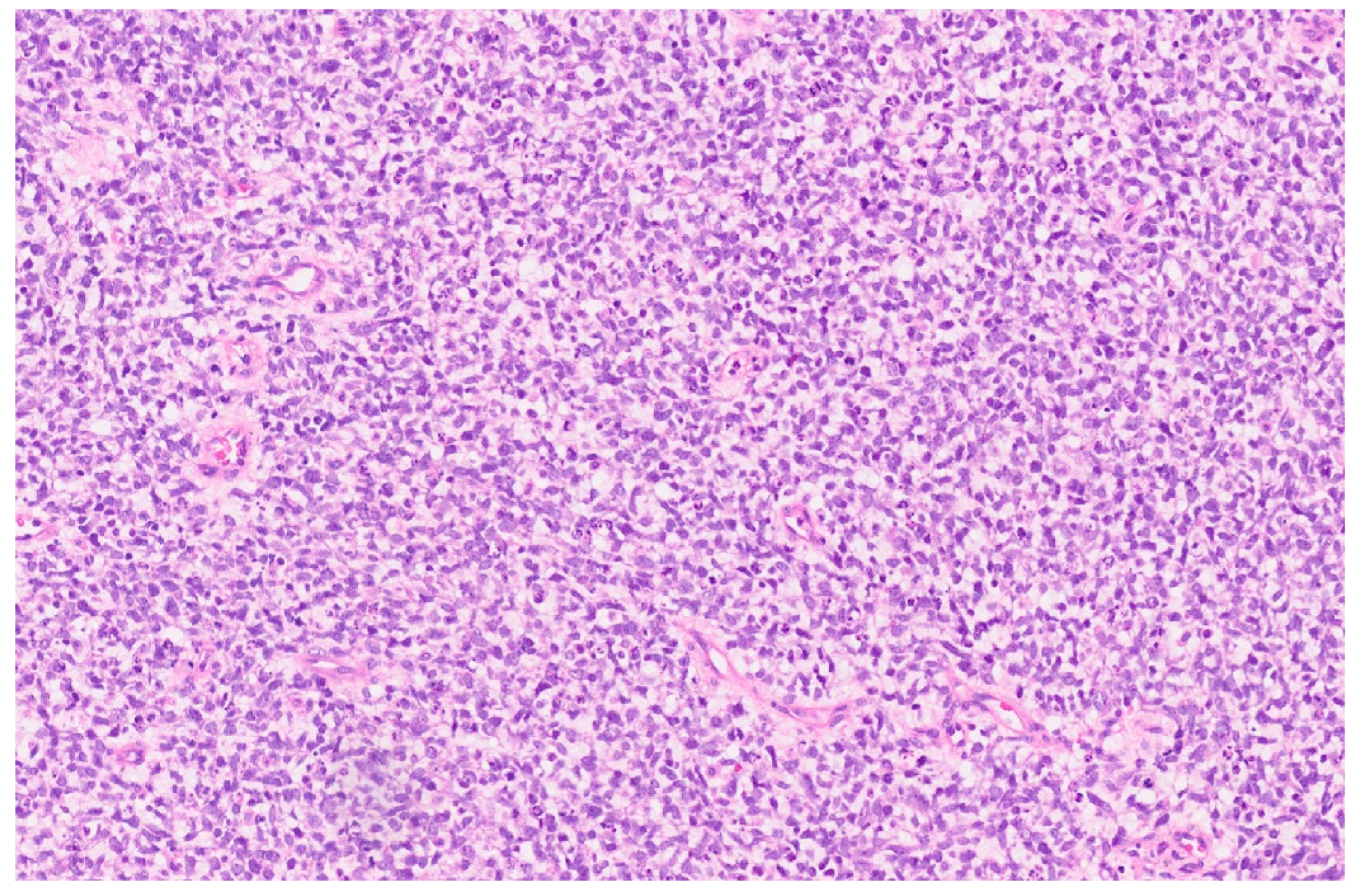 Diagnostics 13 03524 g017