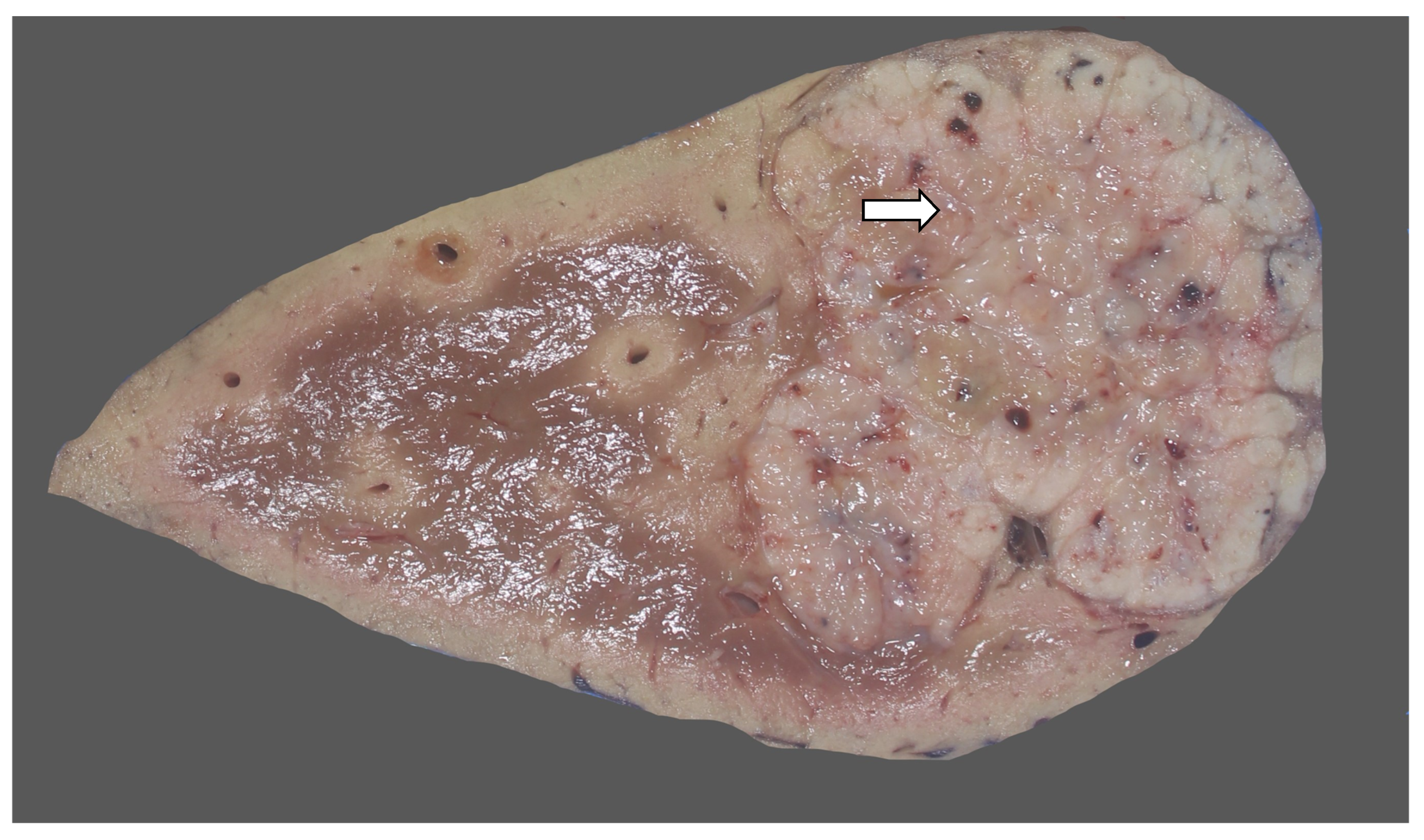 Diagnostics 13 03524 g031