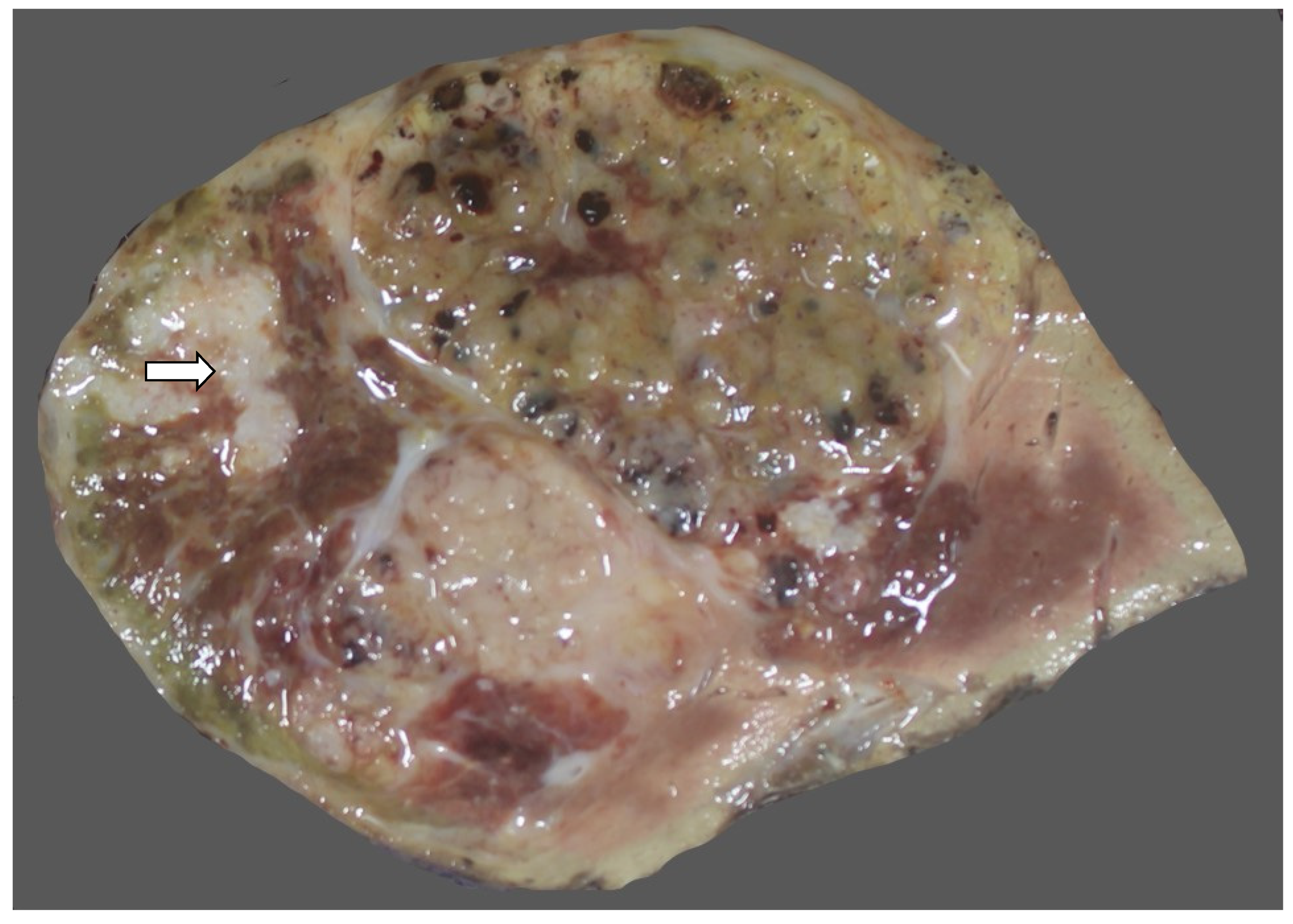 Diagnostics 13 03524 g032