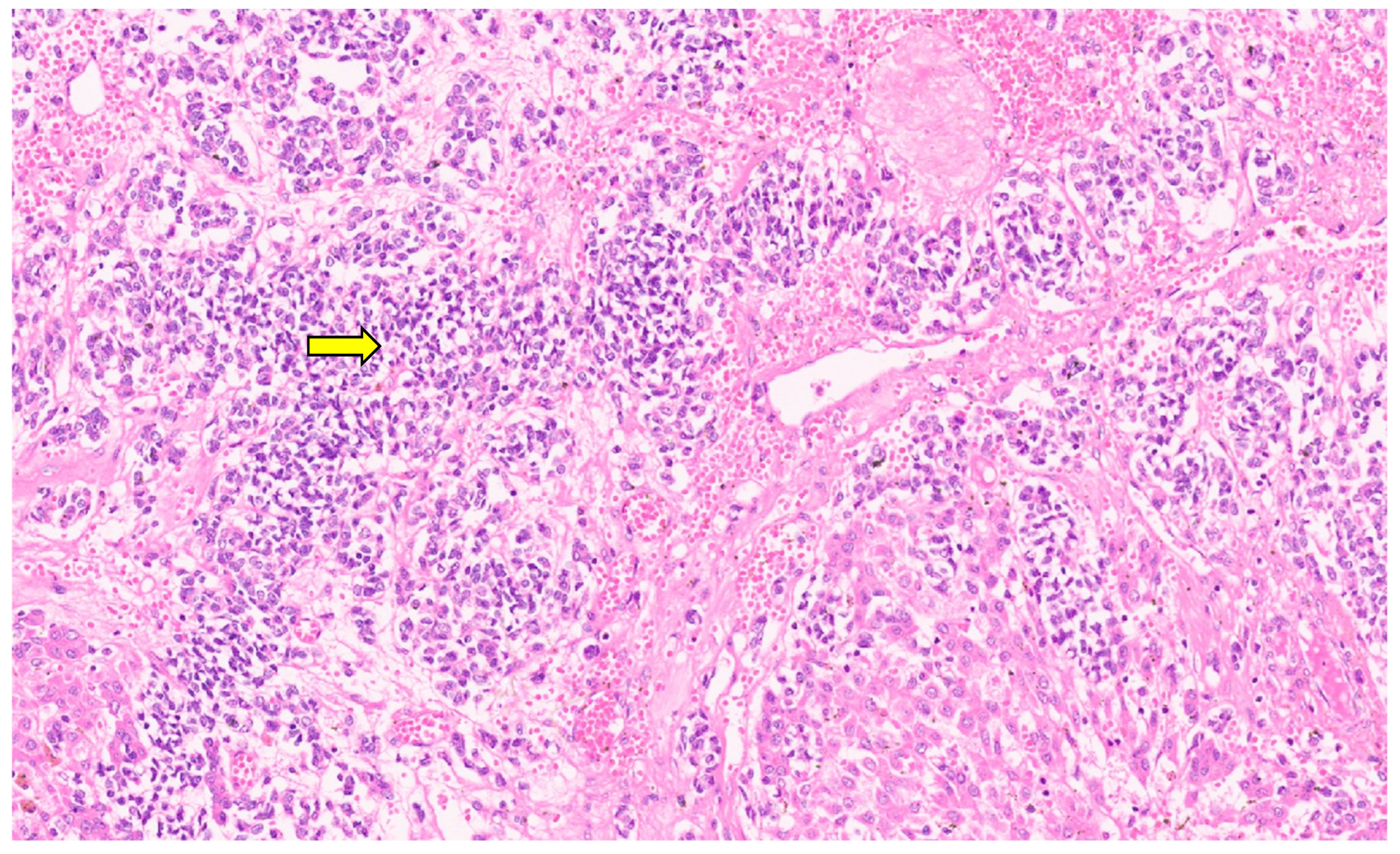 Diagnostics 13 03524 g044