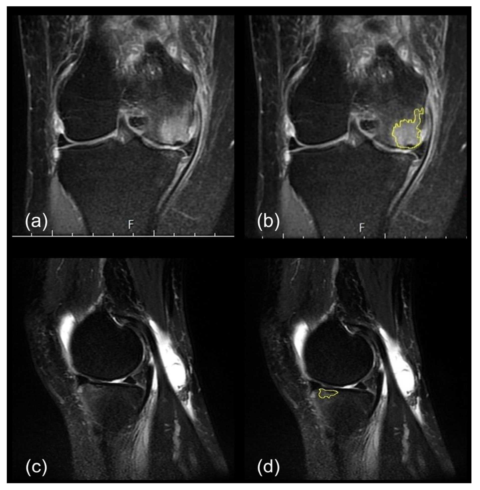 Diagnostics 13 03532 g002