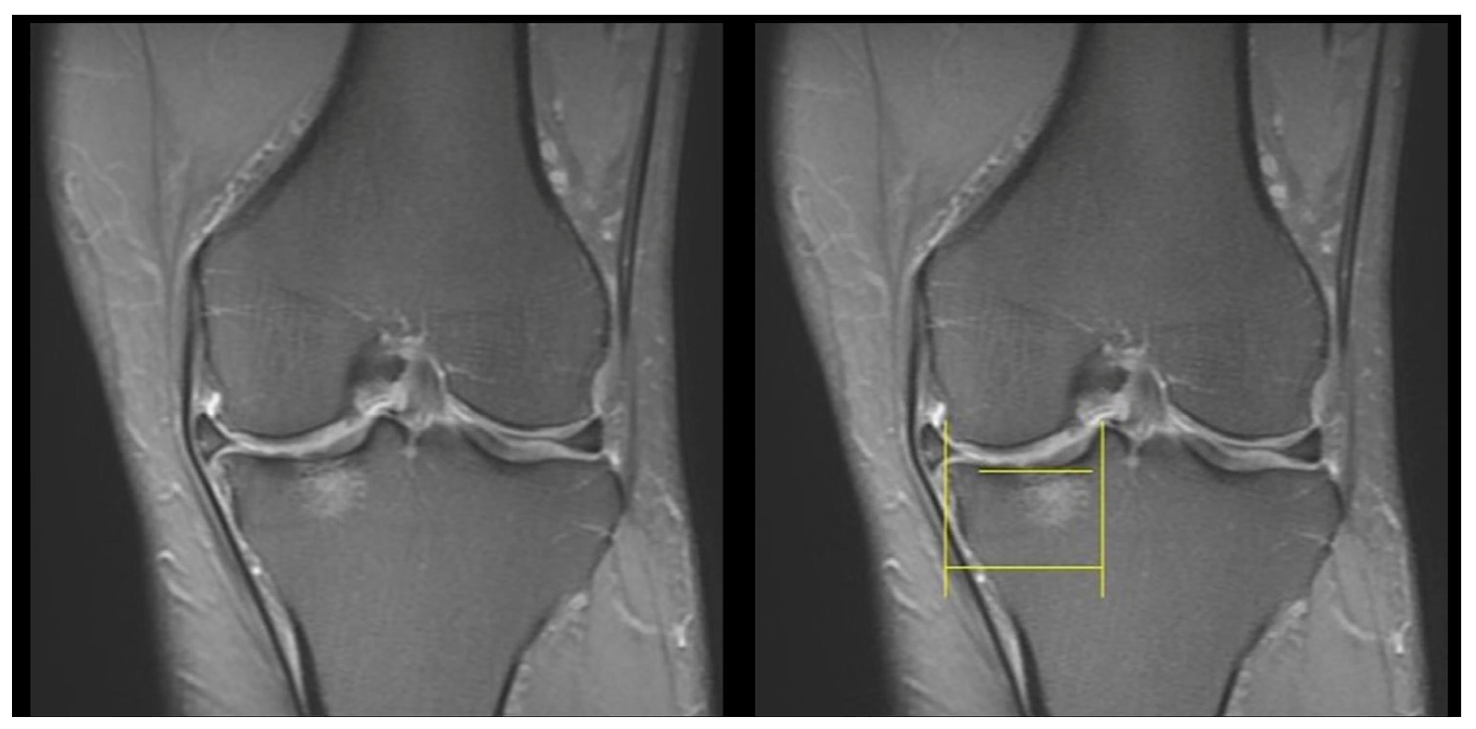 Diagnostics 13 03532 g003