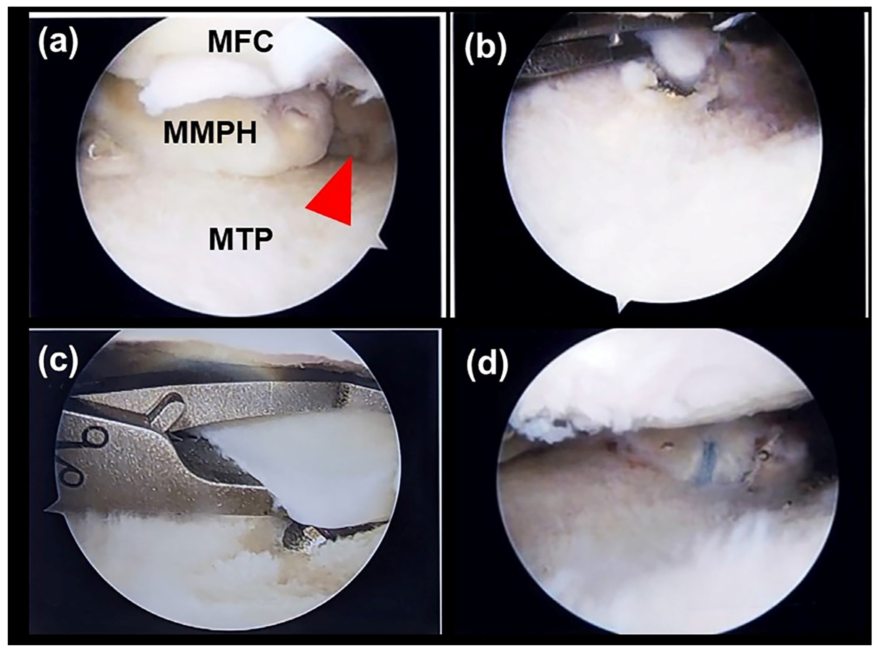 Diagnostics 13 03532 g004
