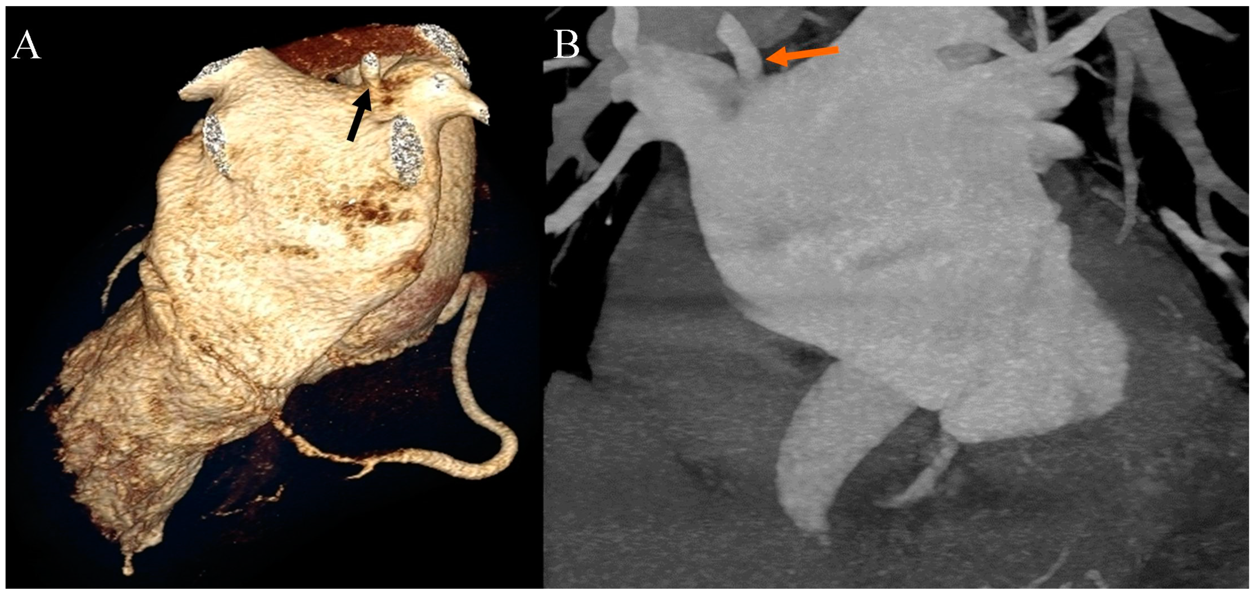 Diagnostics 13 03555 g004