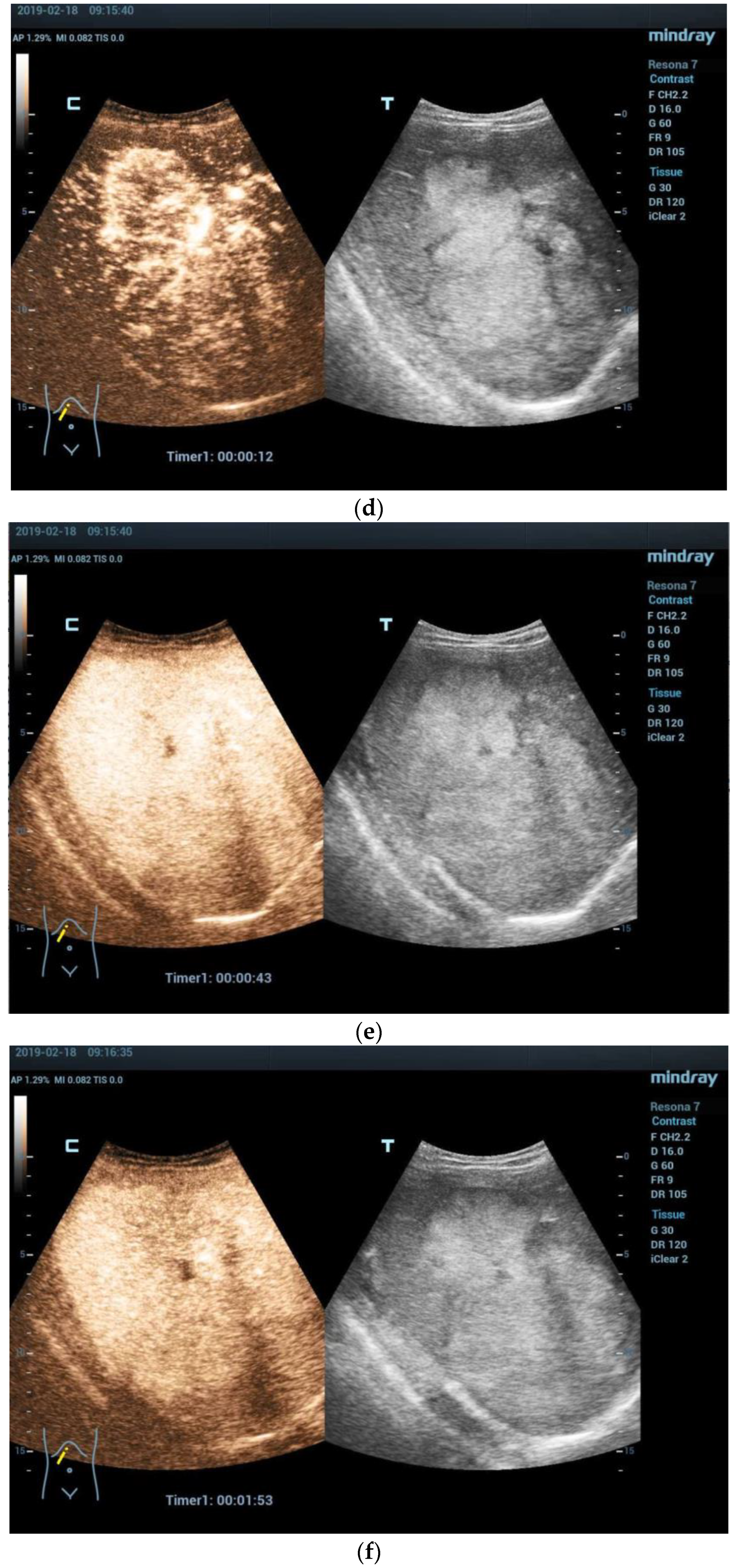 Diagnostics 13 03568 g002b Diagnostics 13 03568 g002b