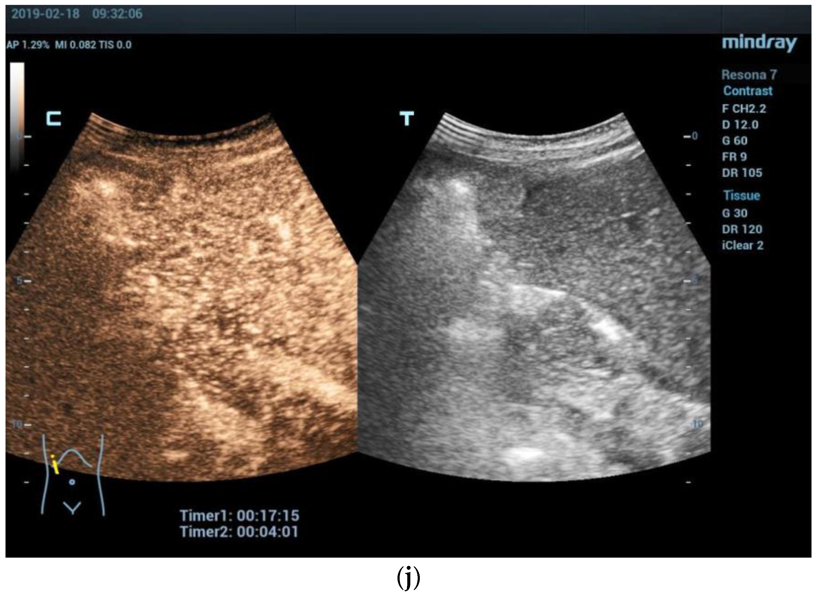 Diagnostics 13 03568 g002d Diagnostics 13 03568 g002d