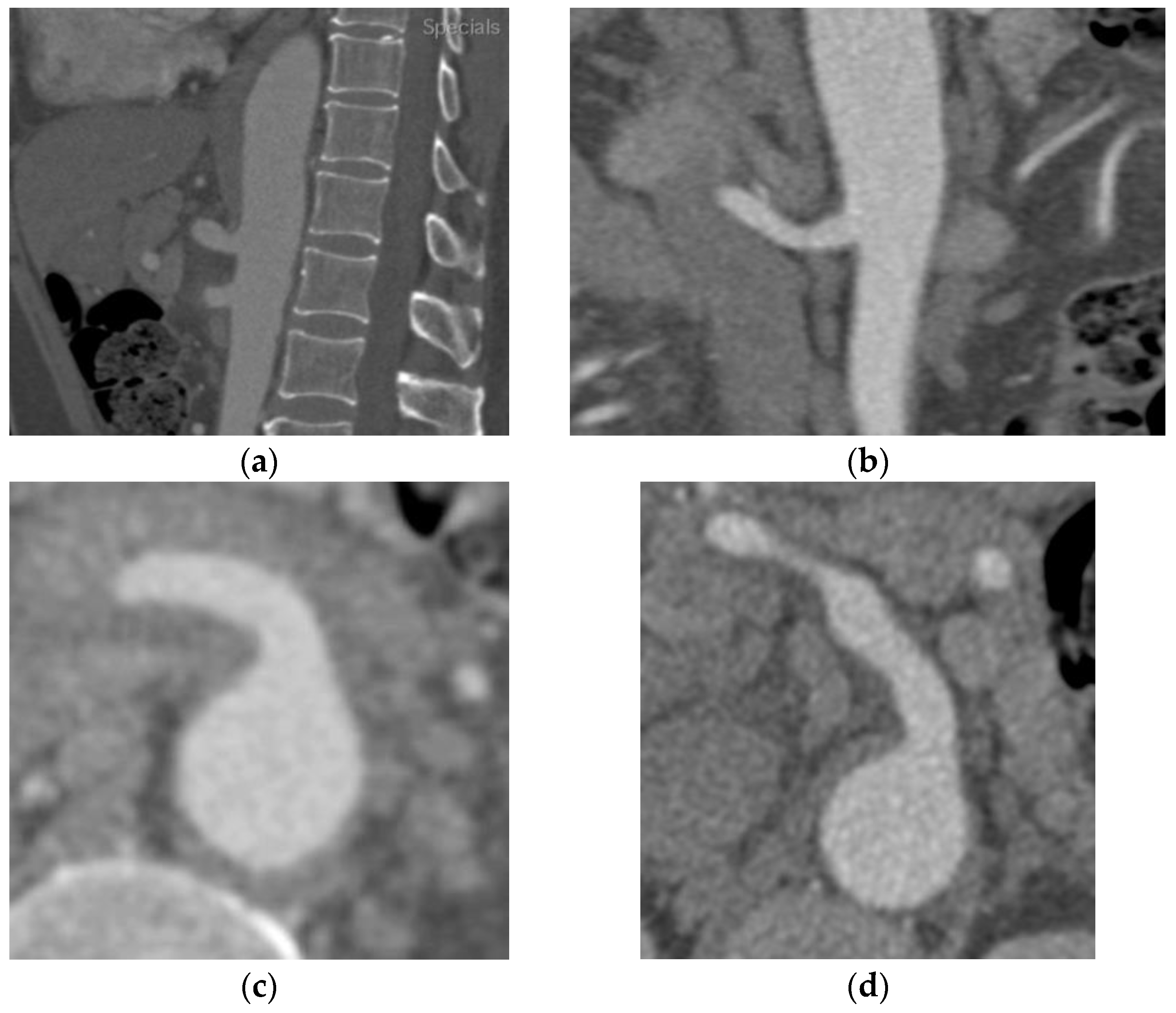 Diagnostics 13 03581 g001 Diagnostics 13 03581 g001