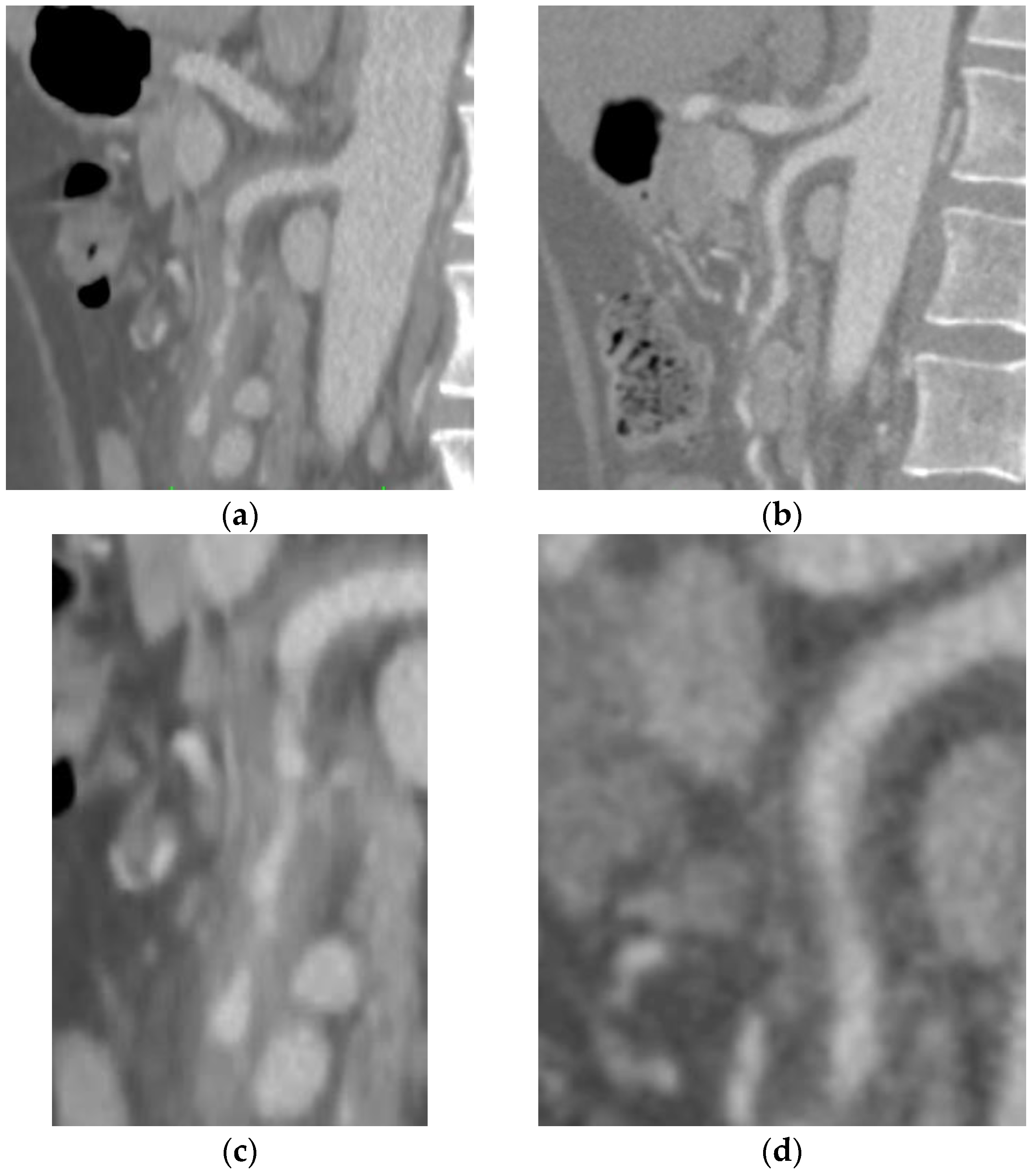 Diagnostics 13 03581 g002 Diagnostics 13 03581 g002